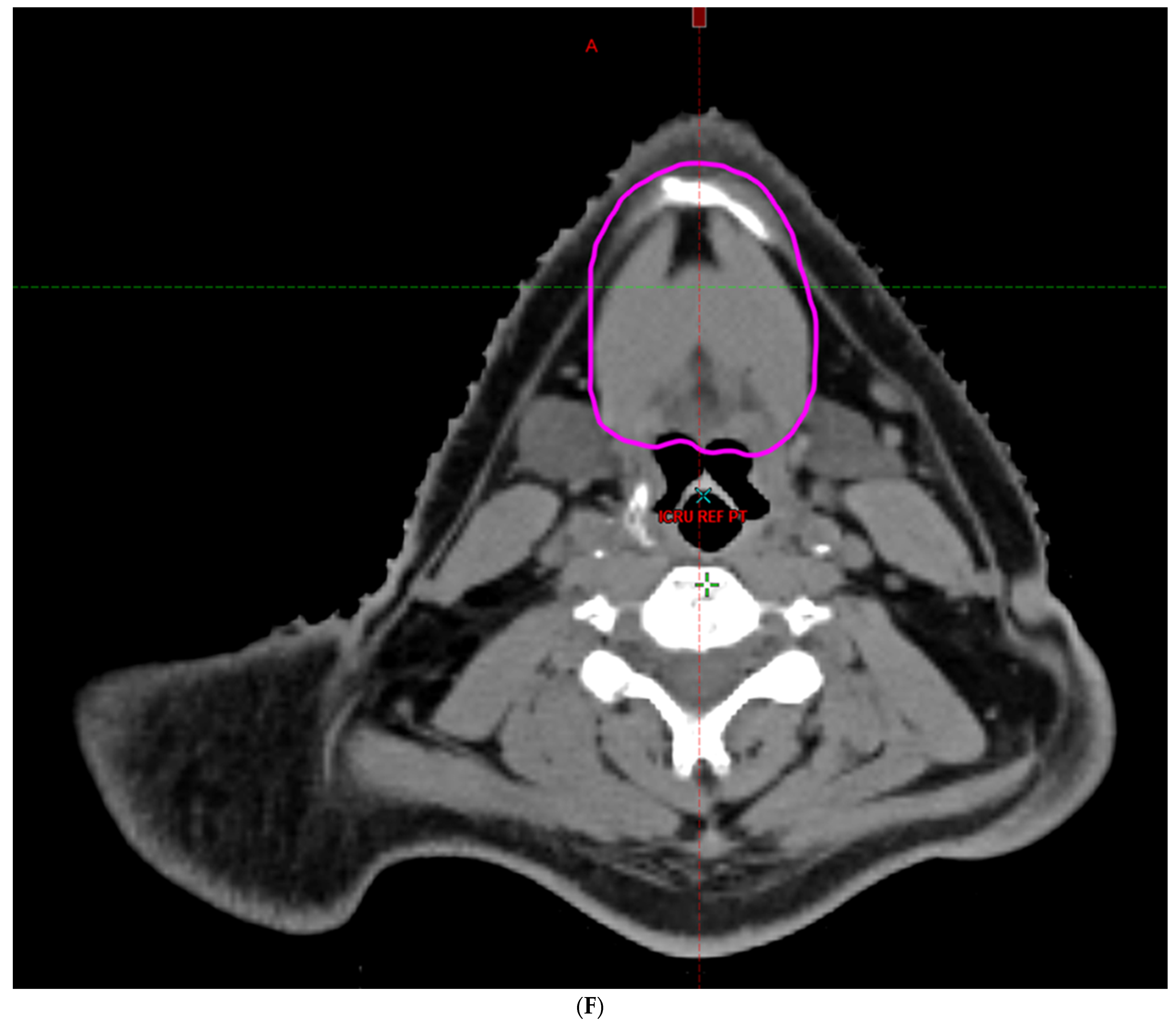 Cancers 16 00349 g002f