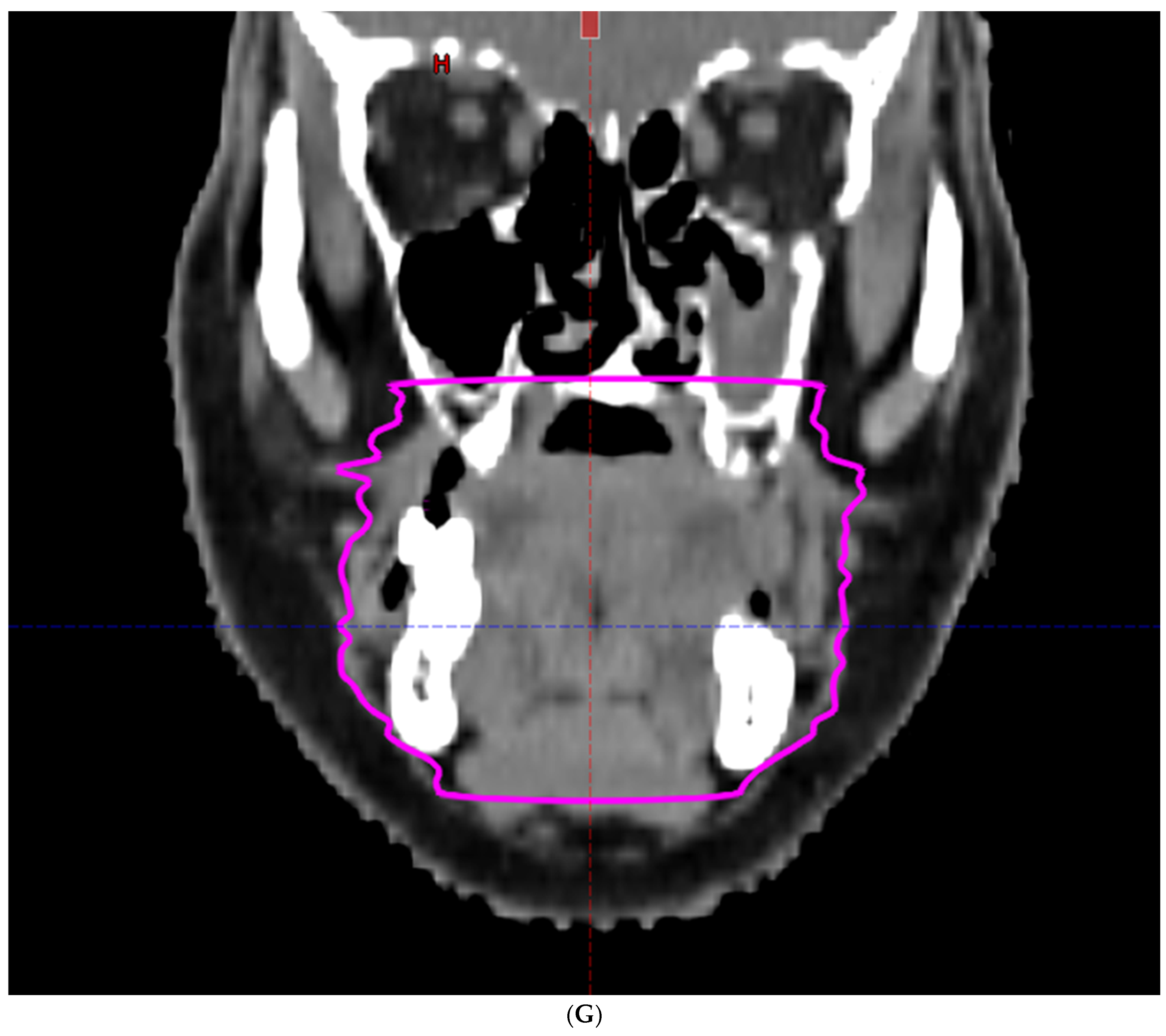 Cancers 16 00349 g002g
