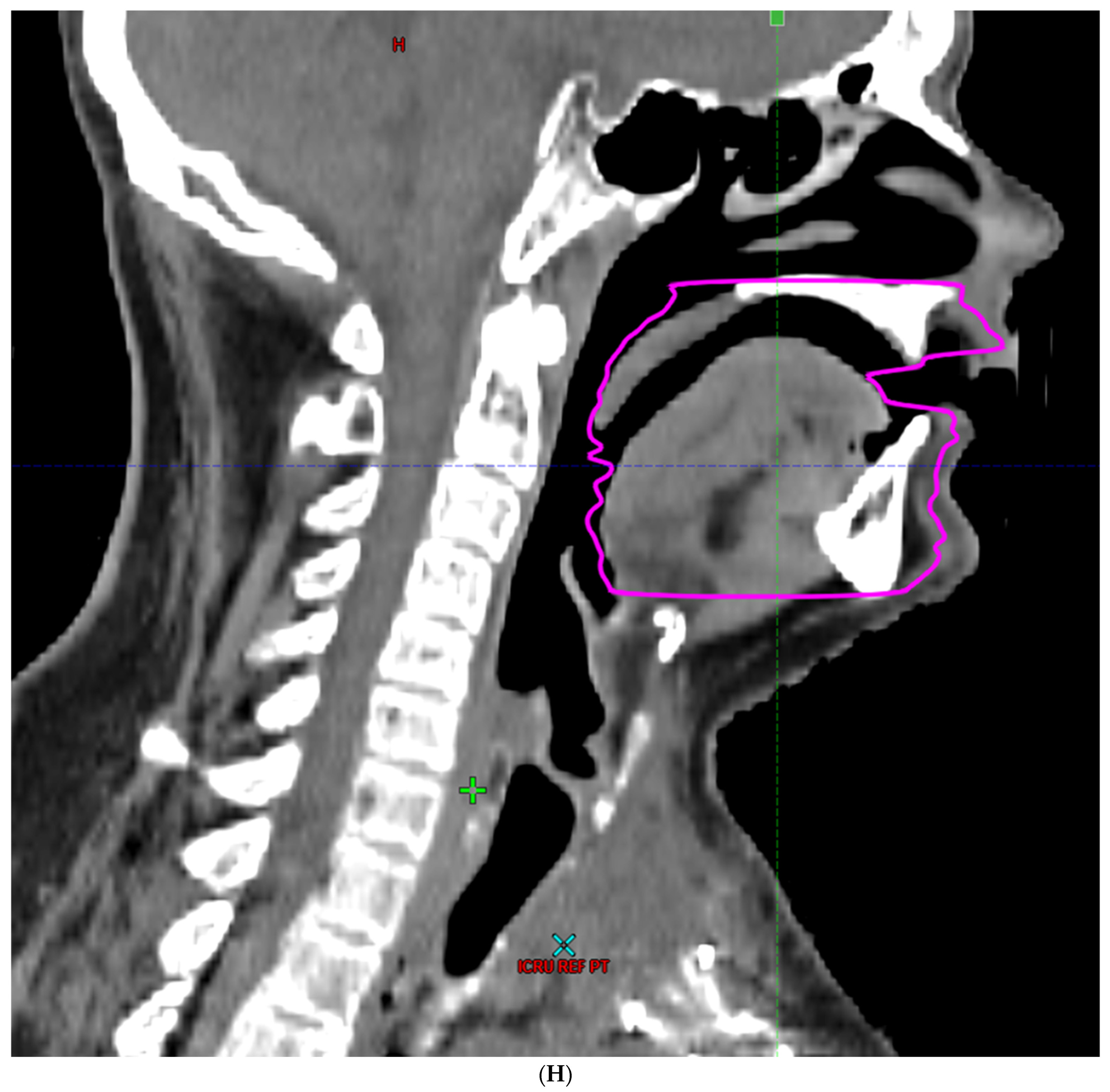 Cancers 16 00349 g002h
