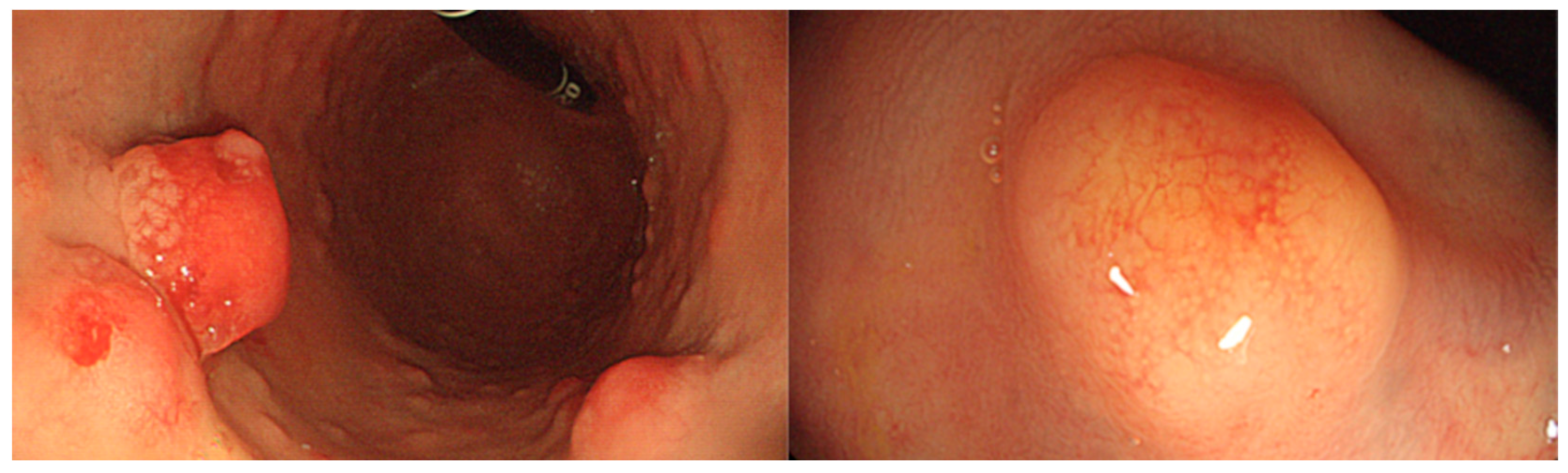 Cancers 16 00352 g001