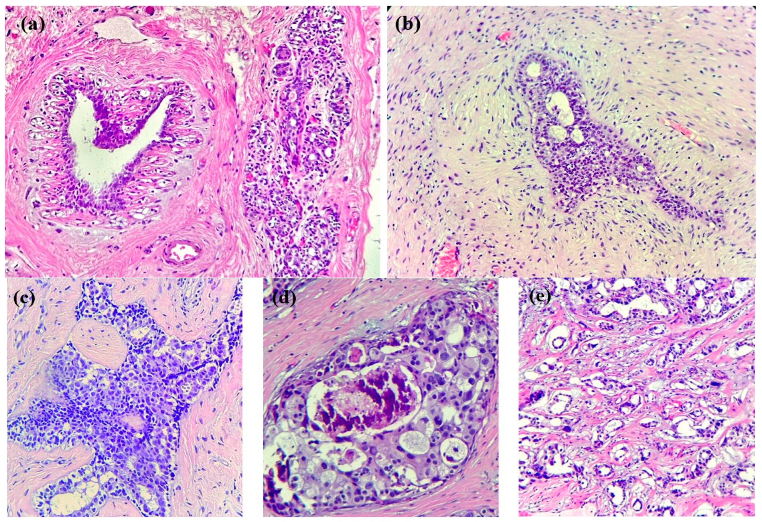 Cancers 16 00381 g001