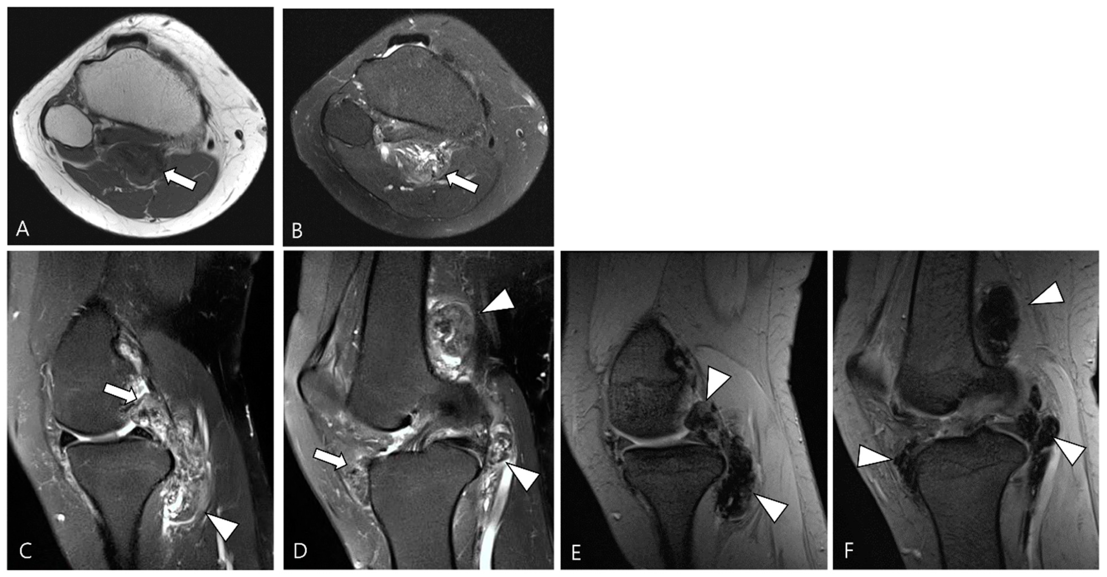 Cancers 16 00402 g001