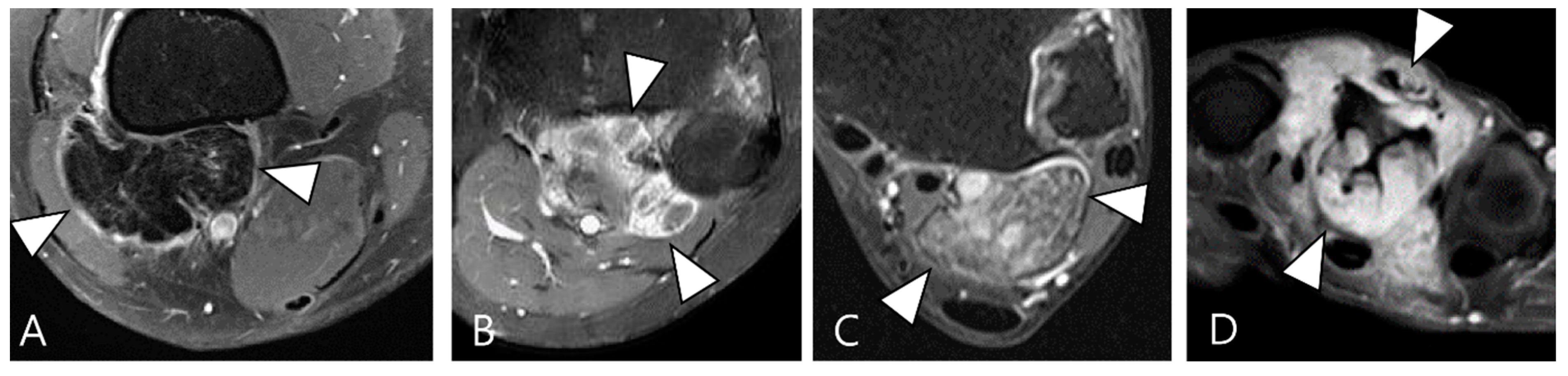 Cancers 16 00402 g002