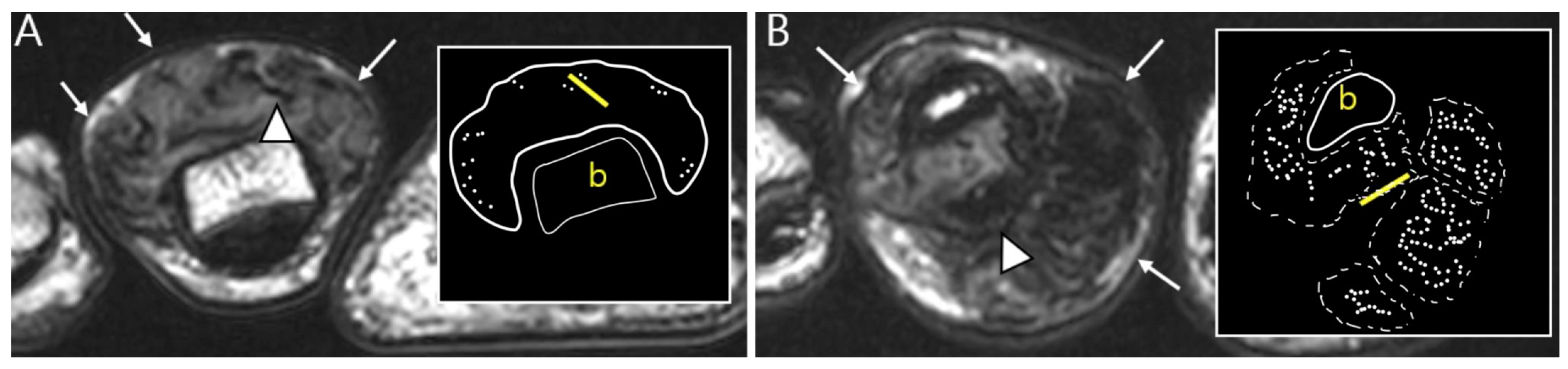 Cancers 16 00402 g005