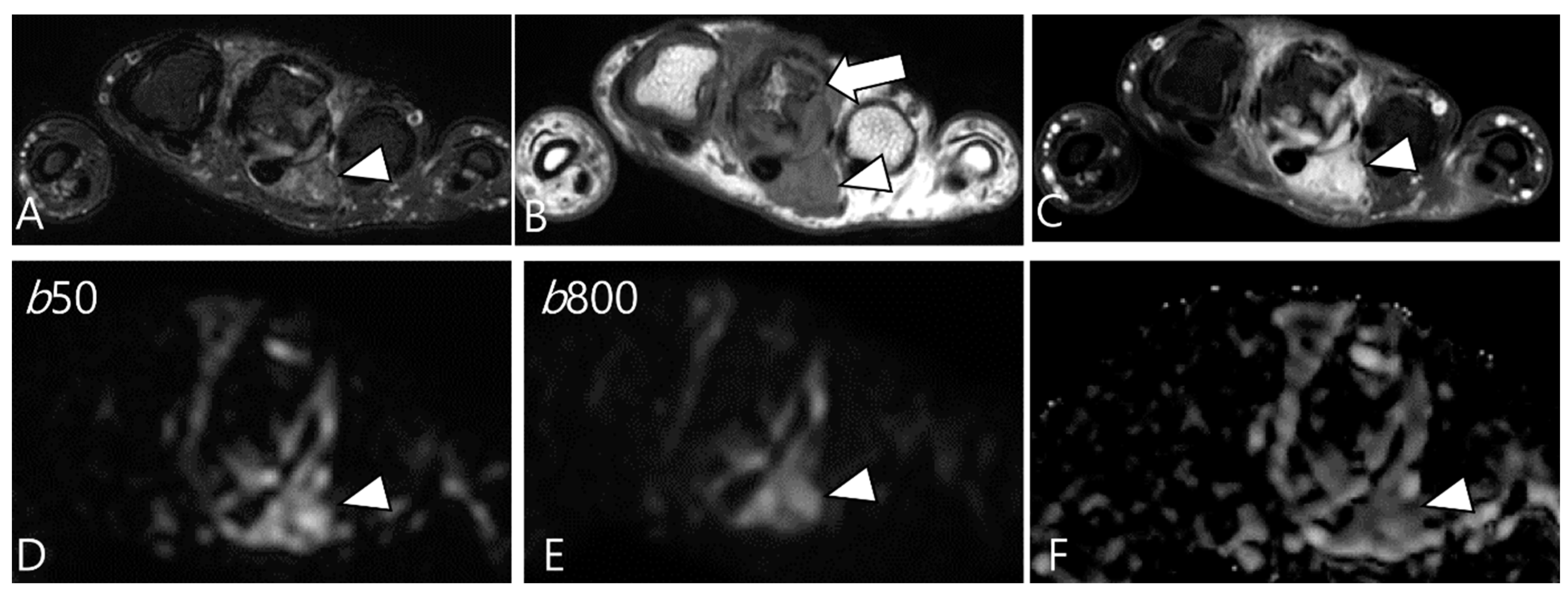 Cancers 16 00402 g009