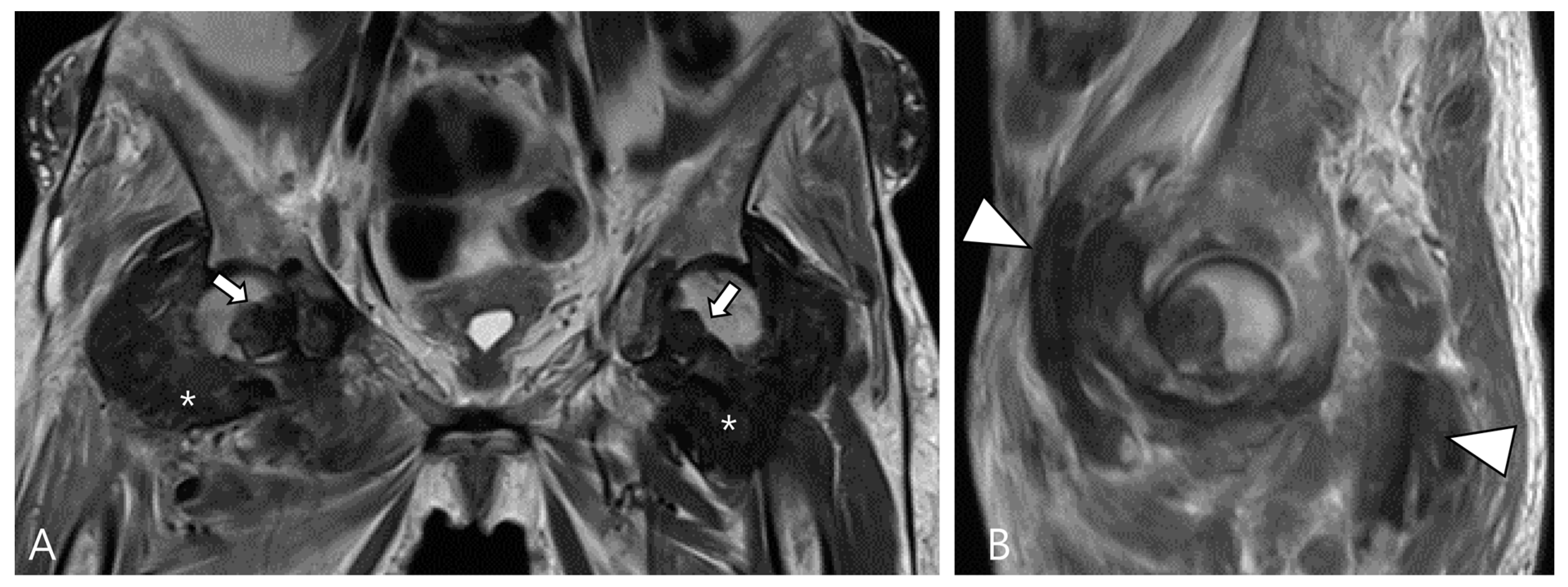 Cancers 16 00402 g012