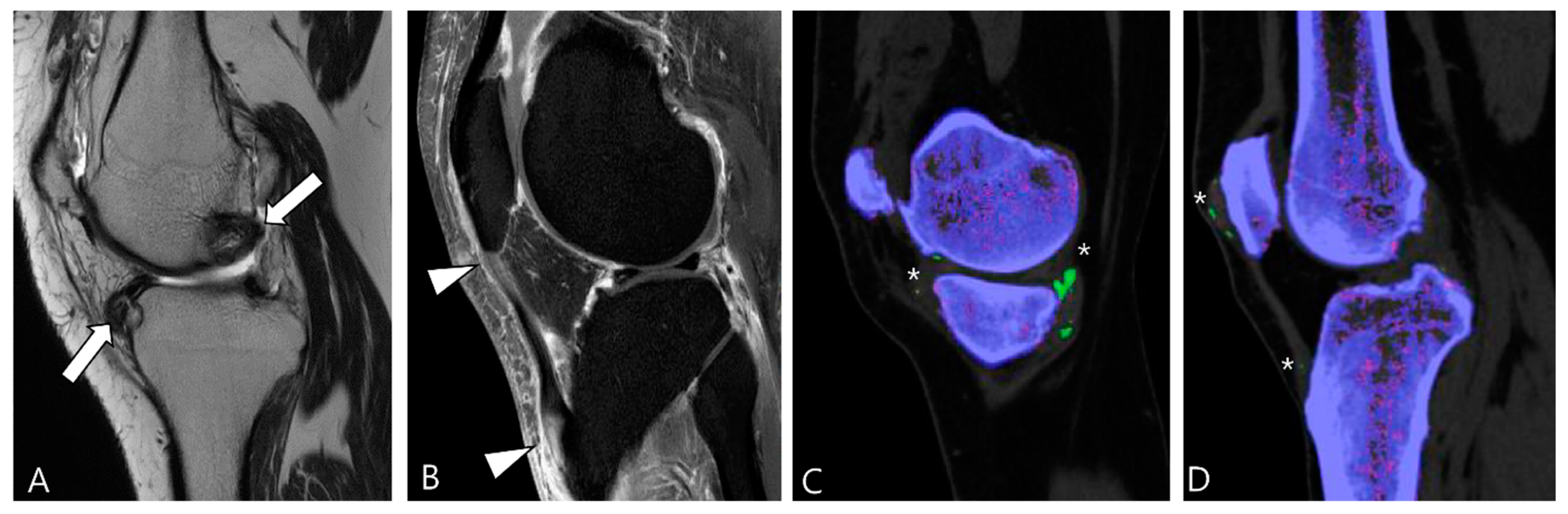 Cancers 16 00402 g014