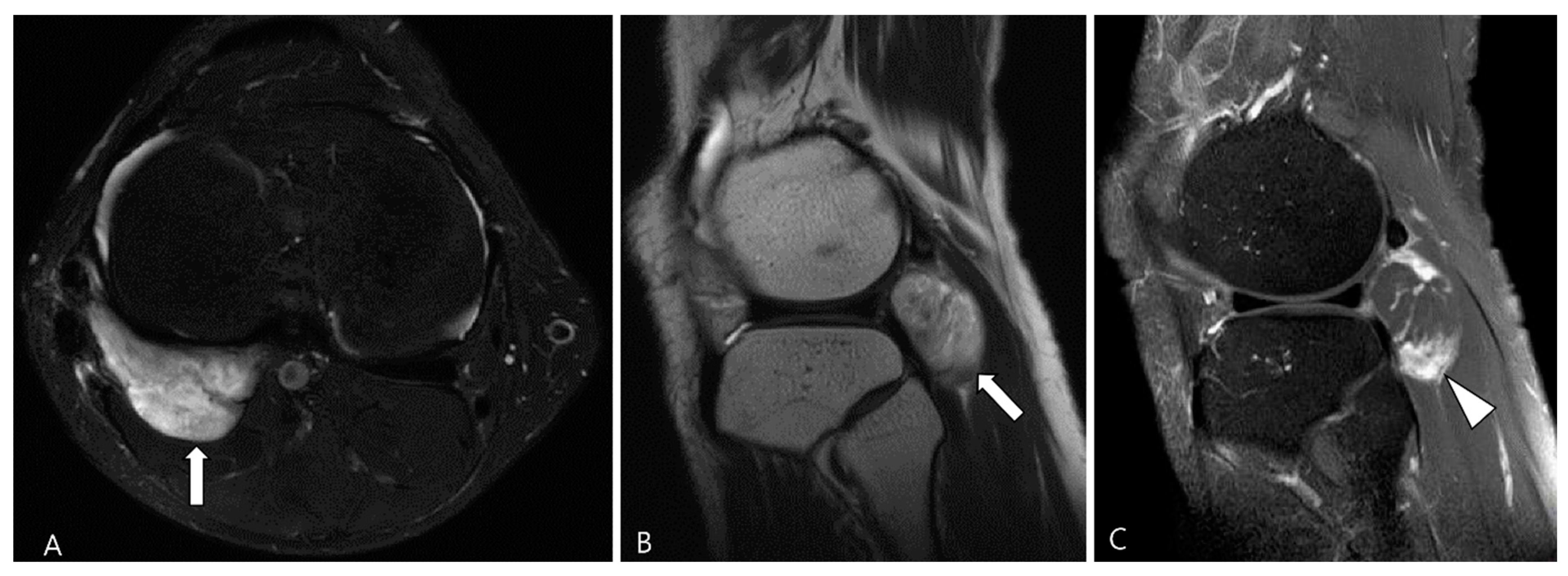 Cancers 16 00402 g015