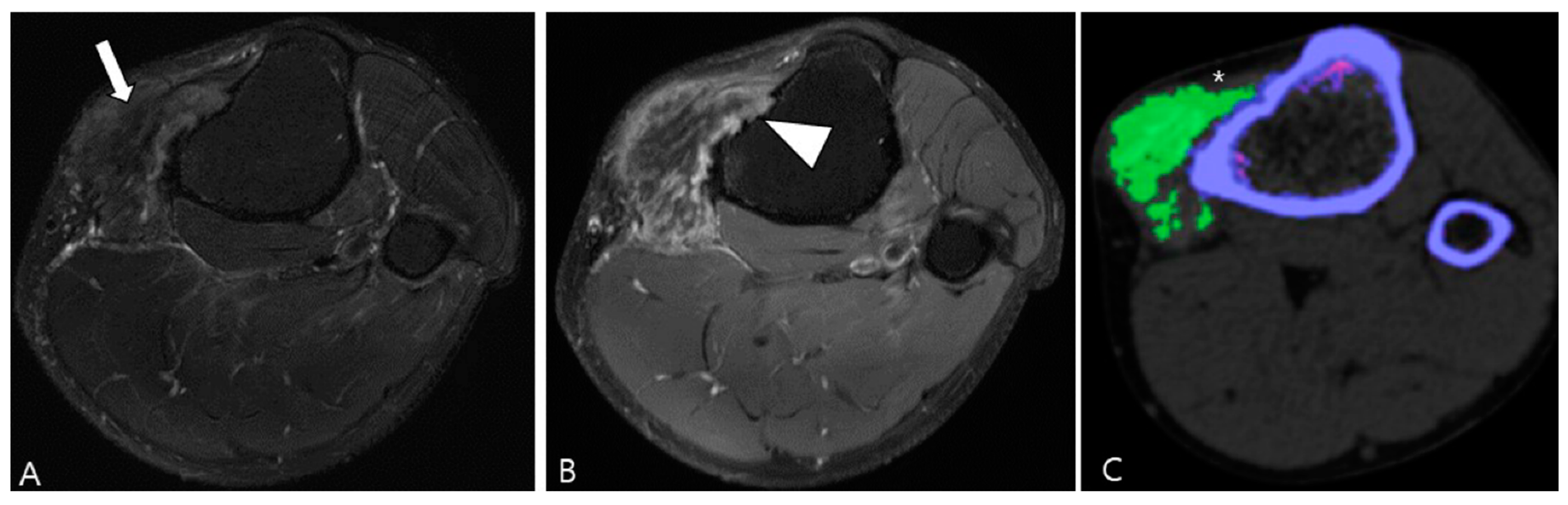 Cancers 16 00402 g017