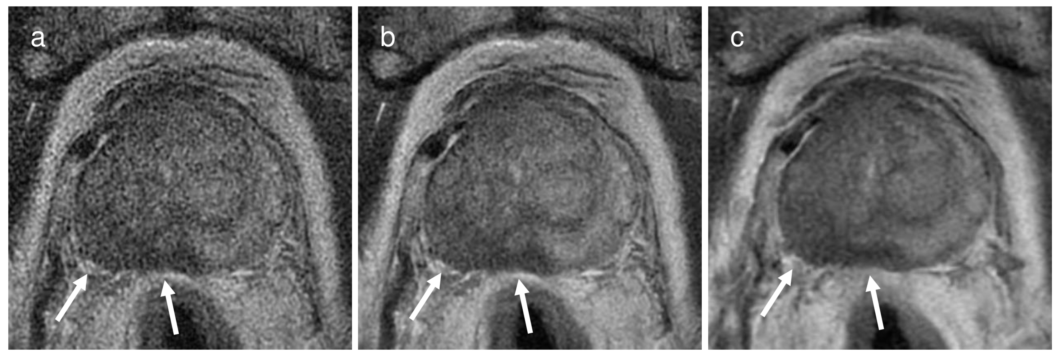 Cancers 16 00413 g002