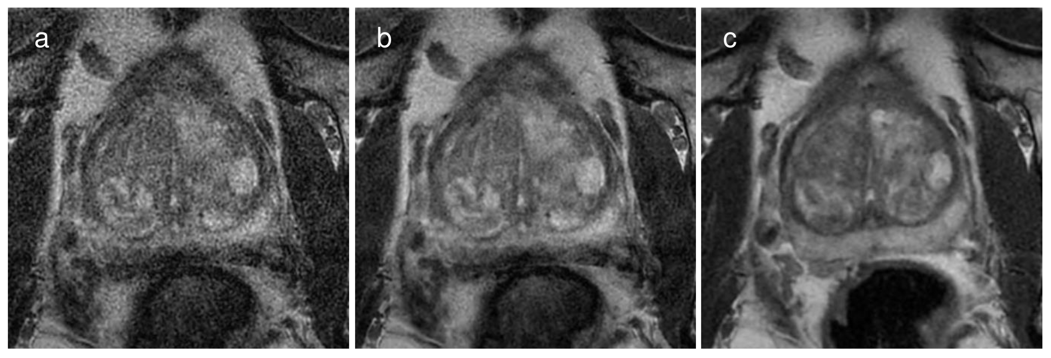 Cancers 16 00413 g003