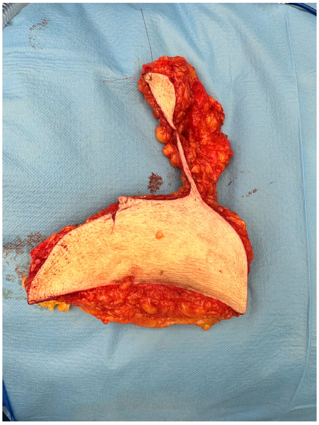 Cancers 16 00497 g001