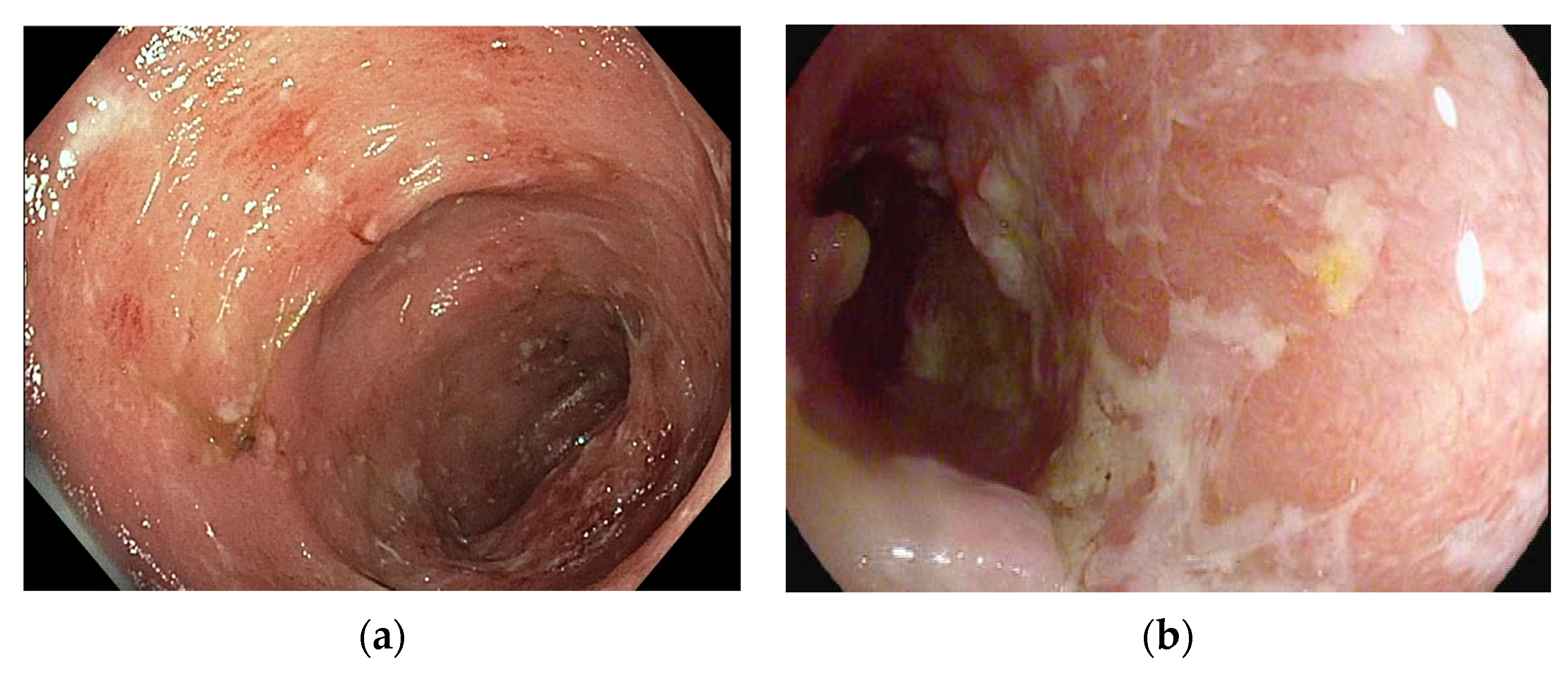 Cancers 16 00501 g002 Cancers 16 00501 g002