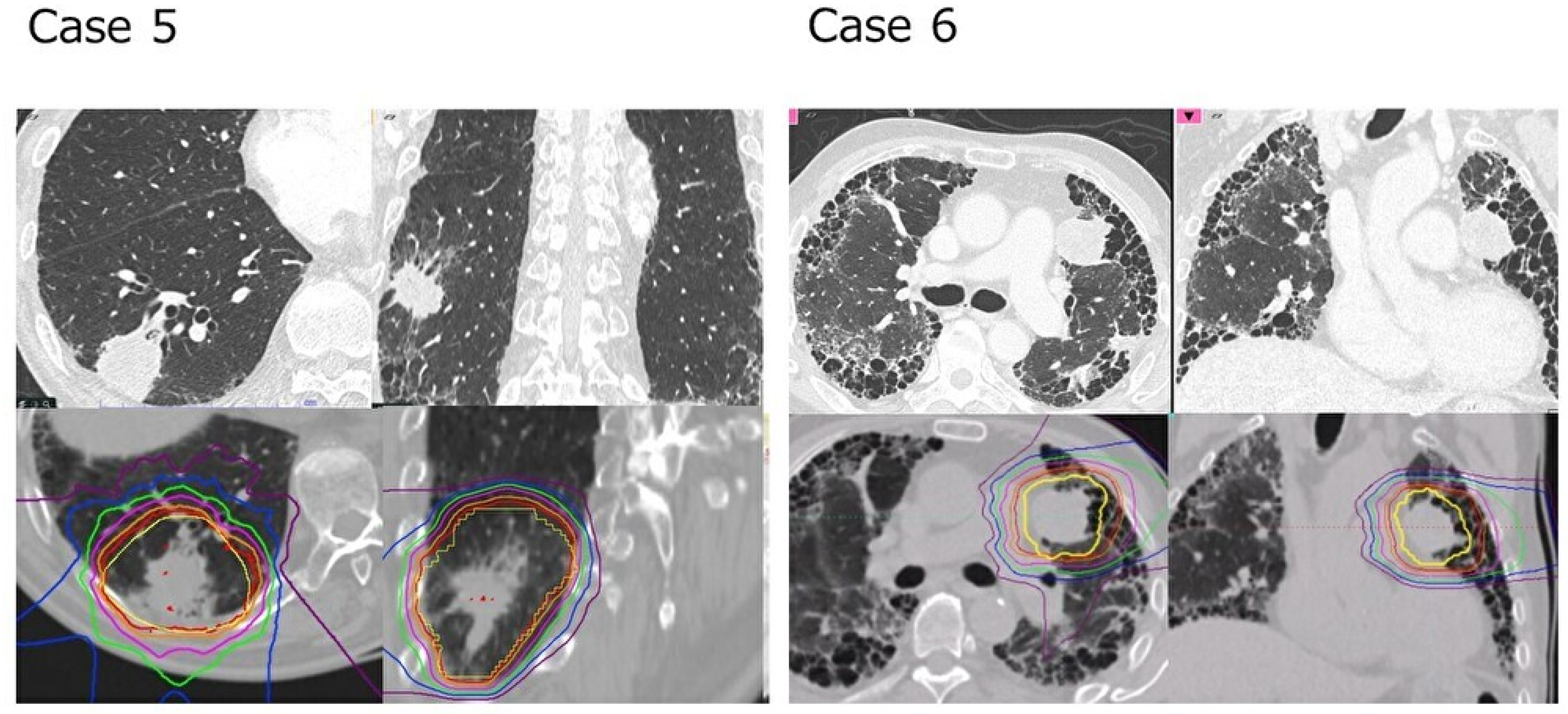 Cancers 16 00562 g002