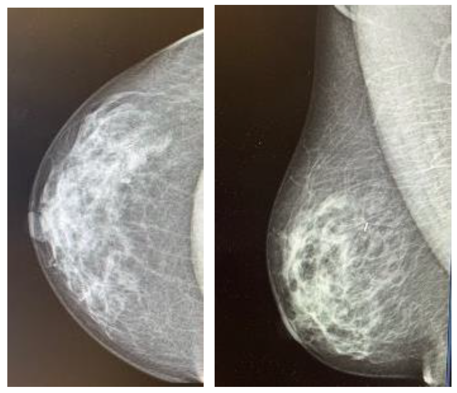 Cancers 16 00566 g001