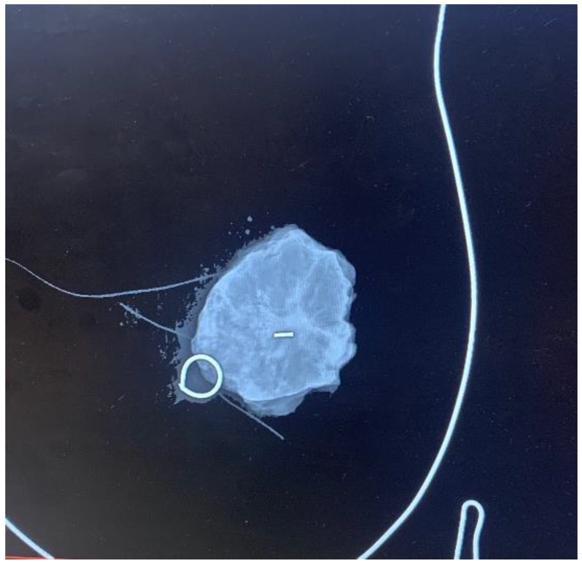 Cancers 16 00566 g002