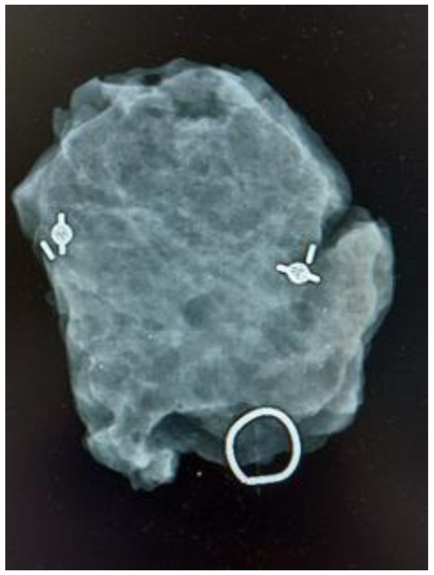 Cancers 16 00566 g003