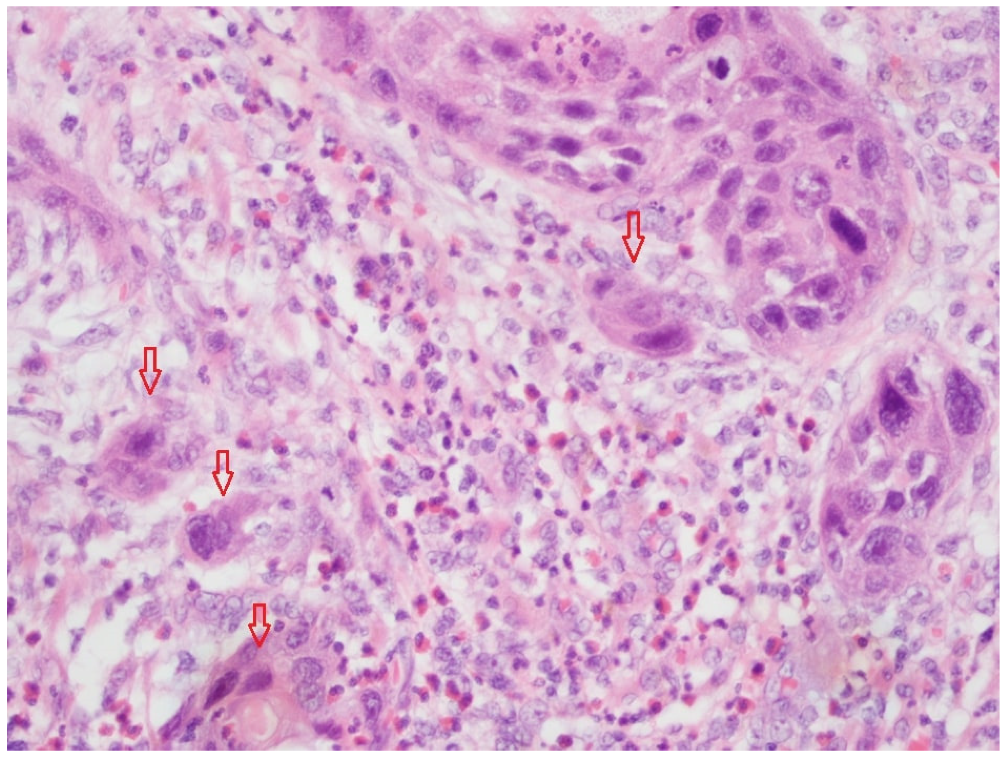 Cancers 16 00587 g001