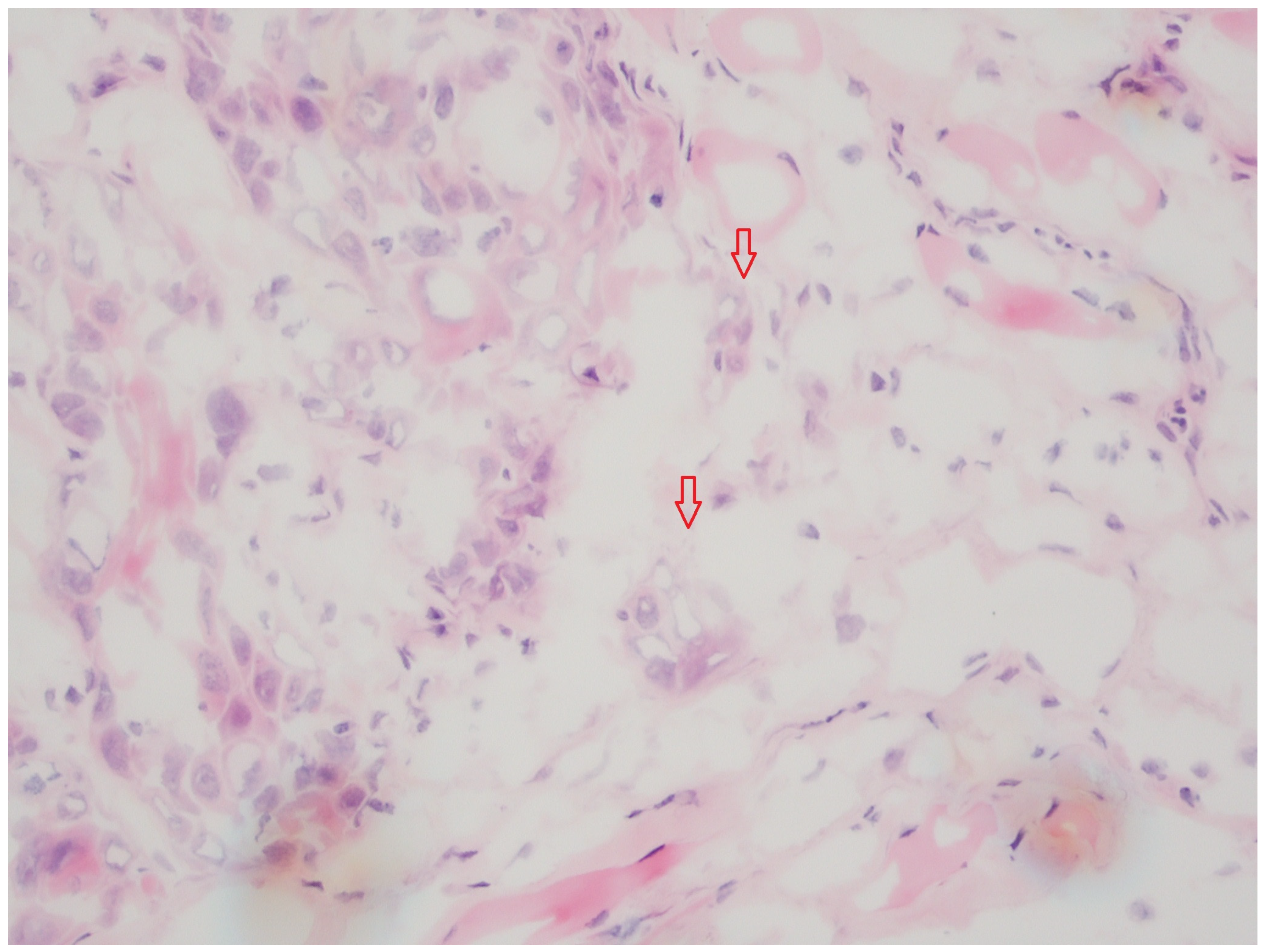 Cancers 16 00587 g002