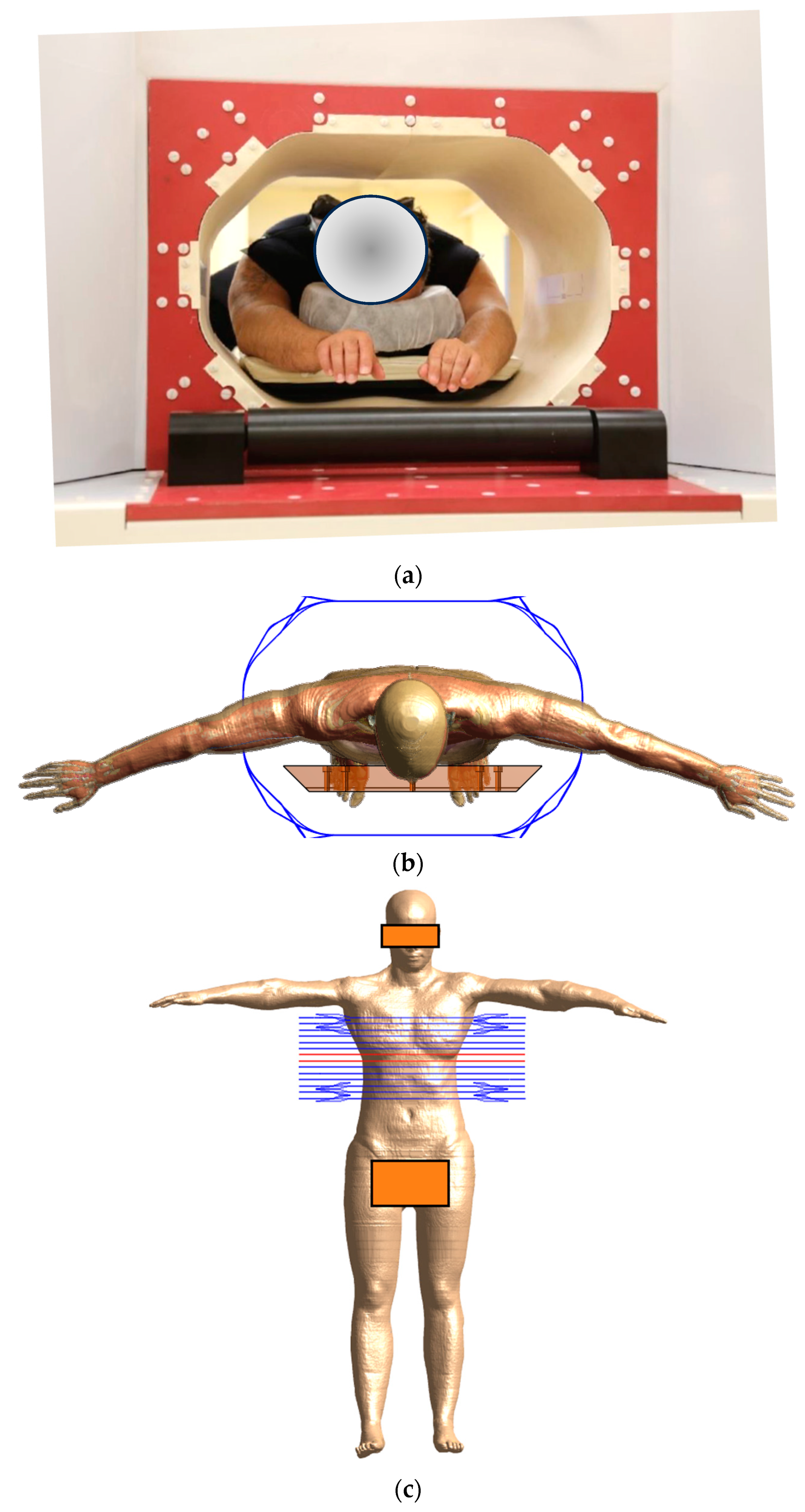 Cancers 16 00621 g005