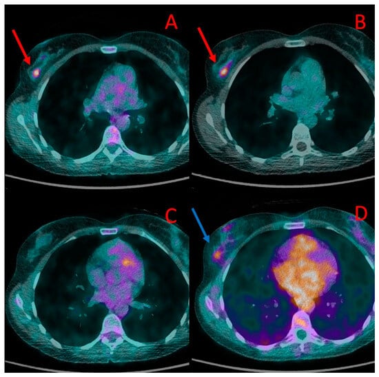 Cancers 16 00667 g001