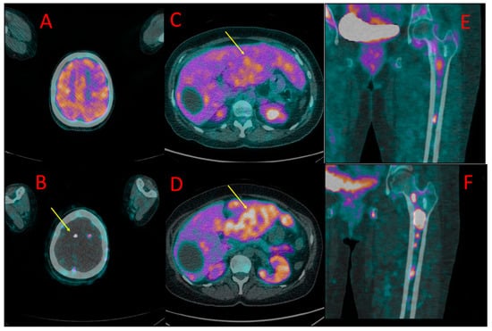 Cancers 16 00667 g003