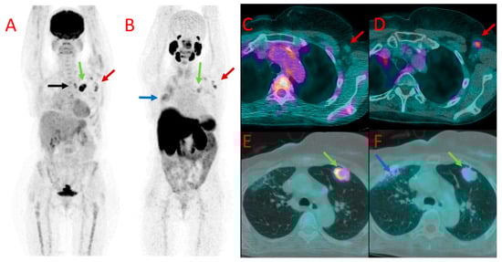 Cancers 16 00667 g004