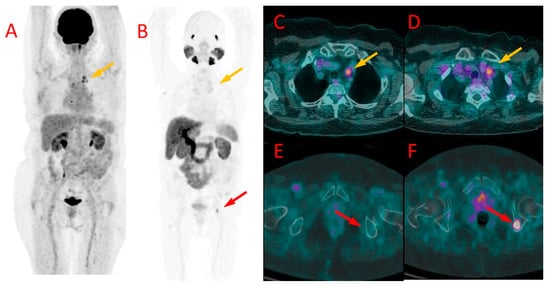 Cancers 16 00667 g005