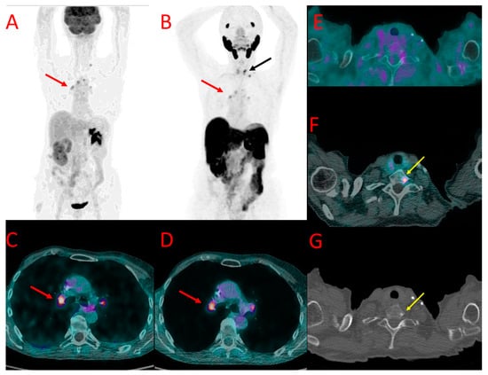 Cancers 16 00667 g006