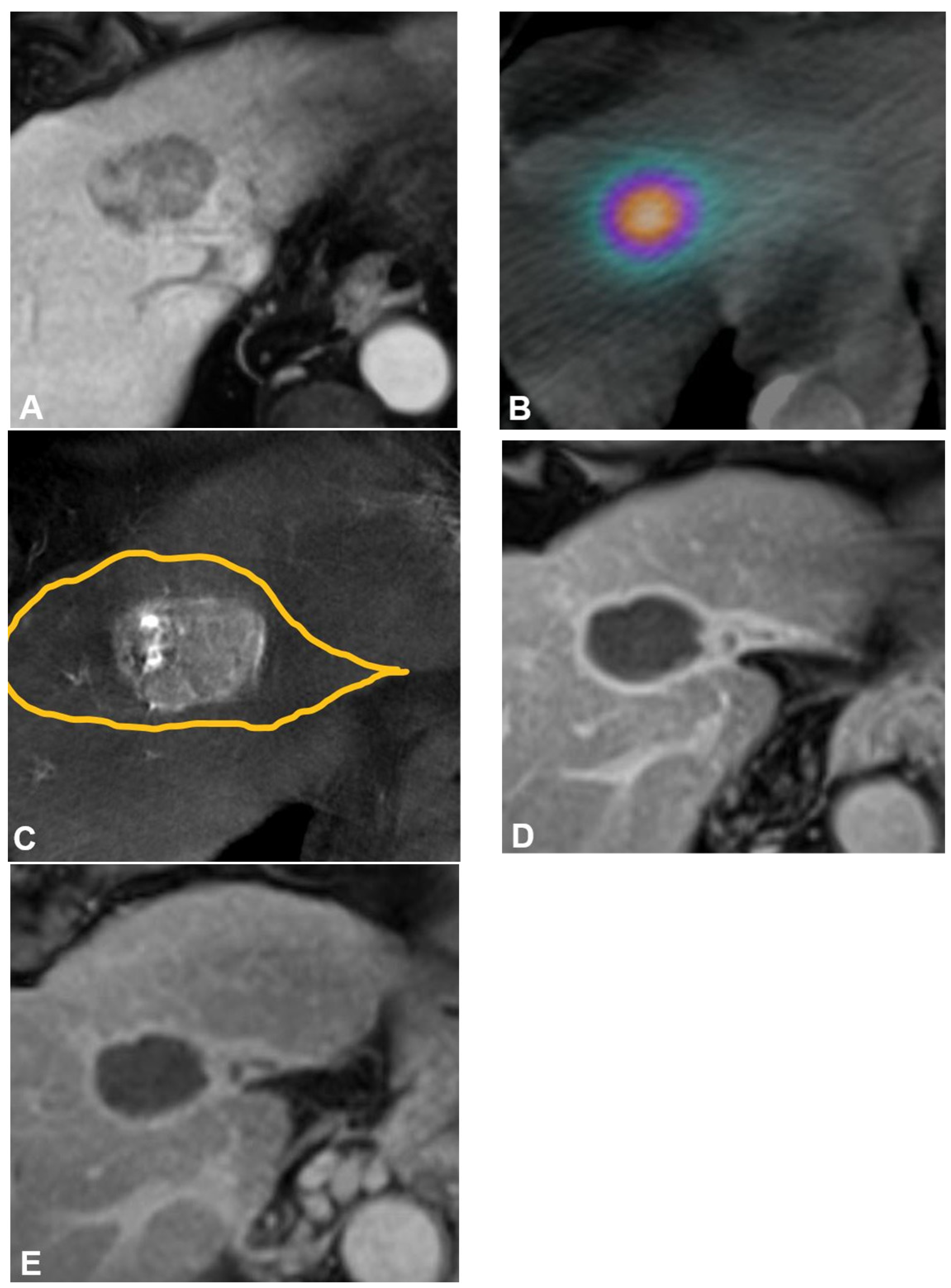 Cancers 16 00669 g001 Cancers 16 00669 g001