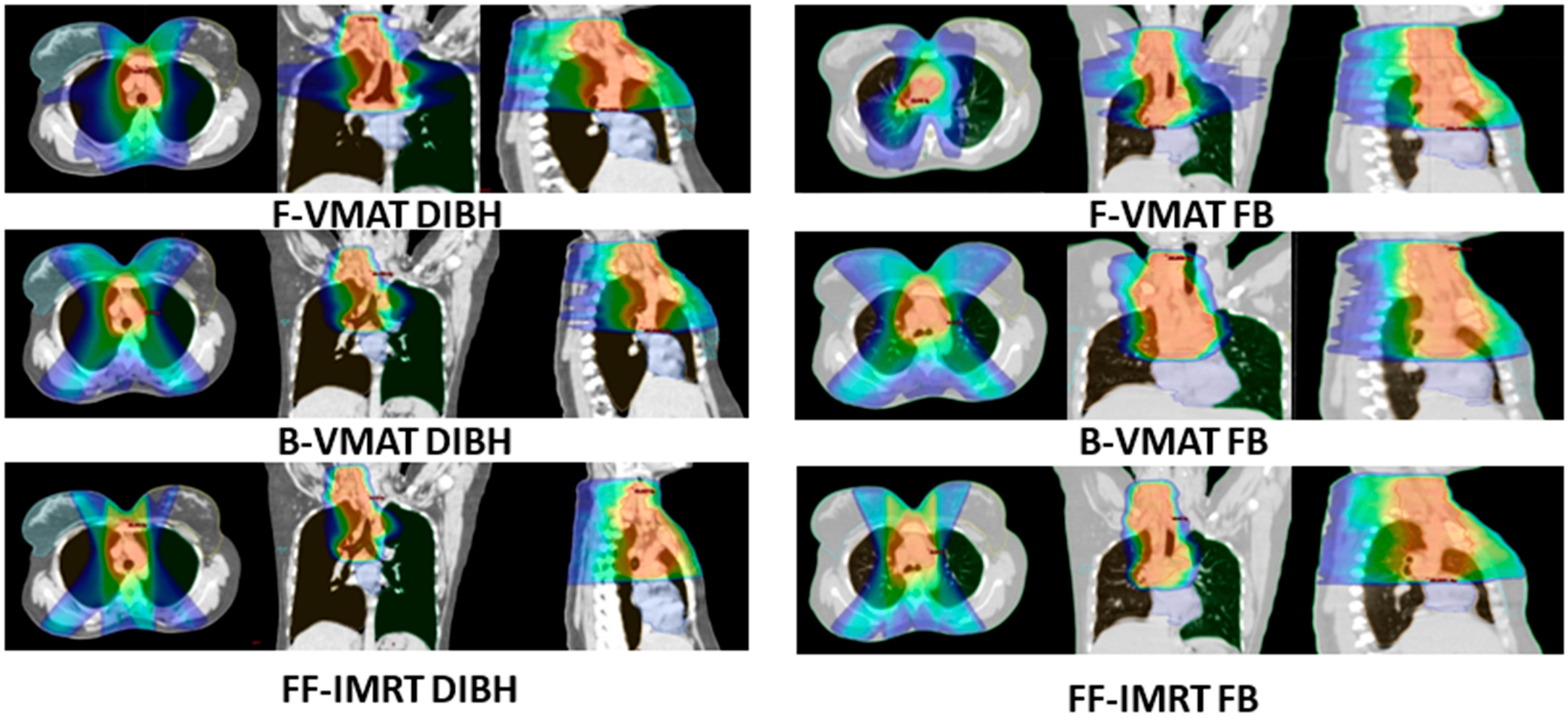 Cancers 16 00690 g002