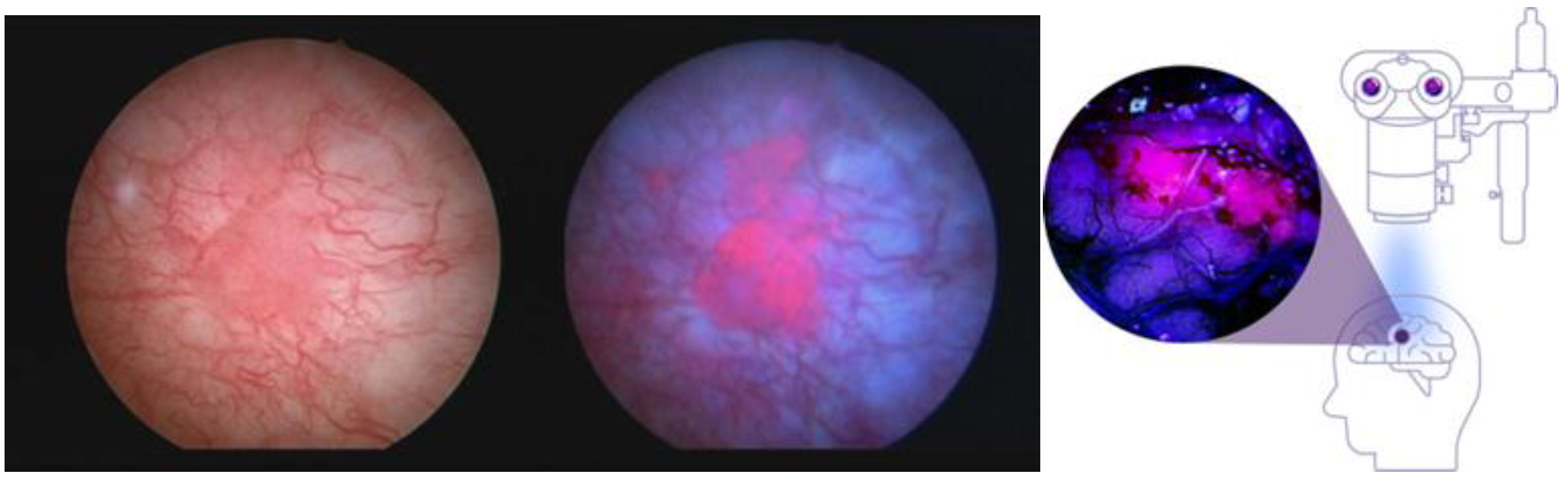 Cancers 16 00740 g005