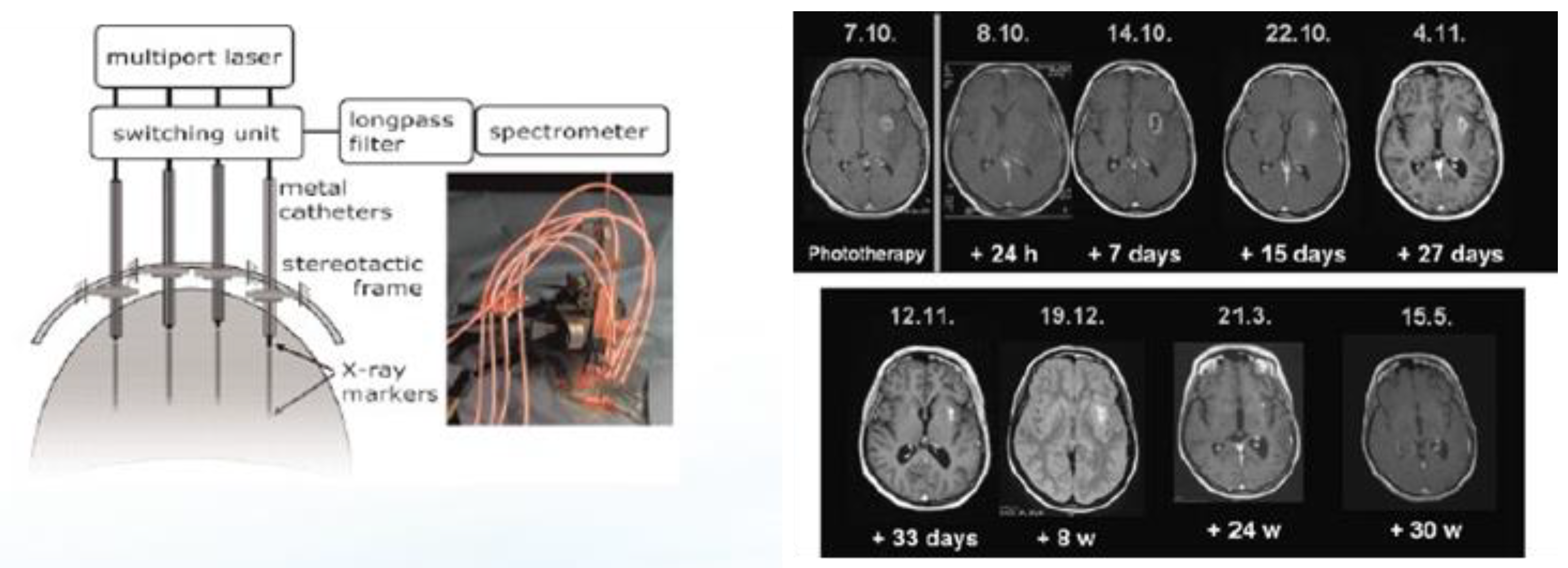 Cancers 16 00740 g006