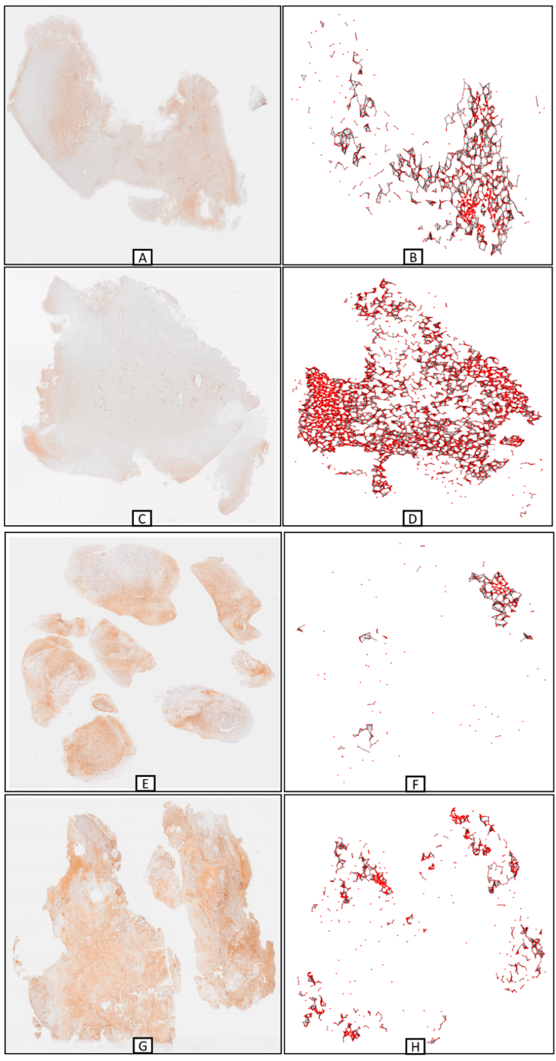 Cancers 16 00750 g004