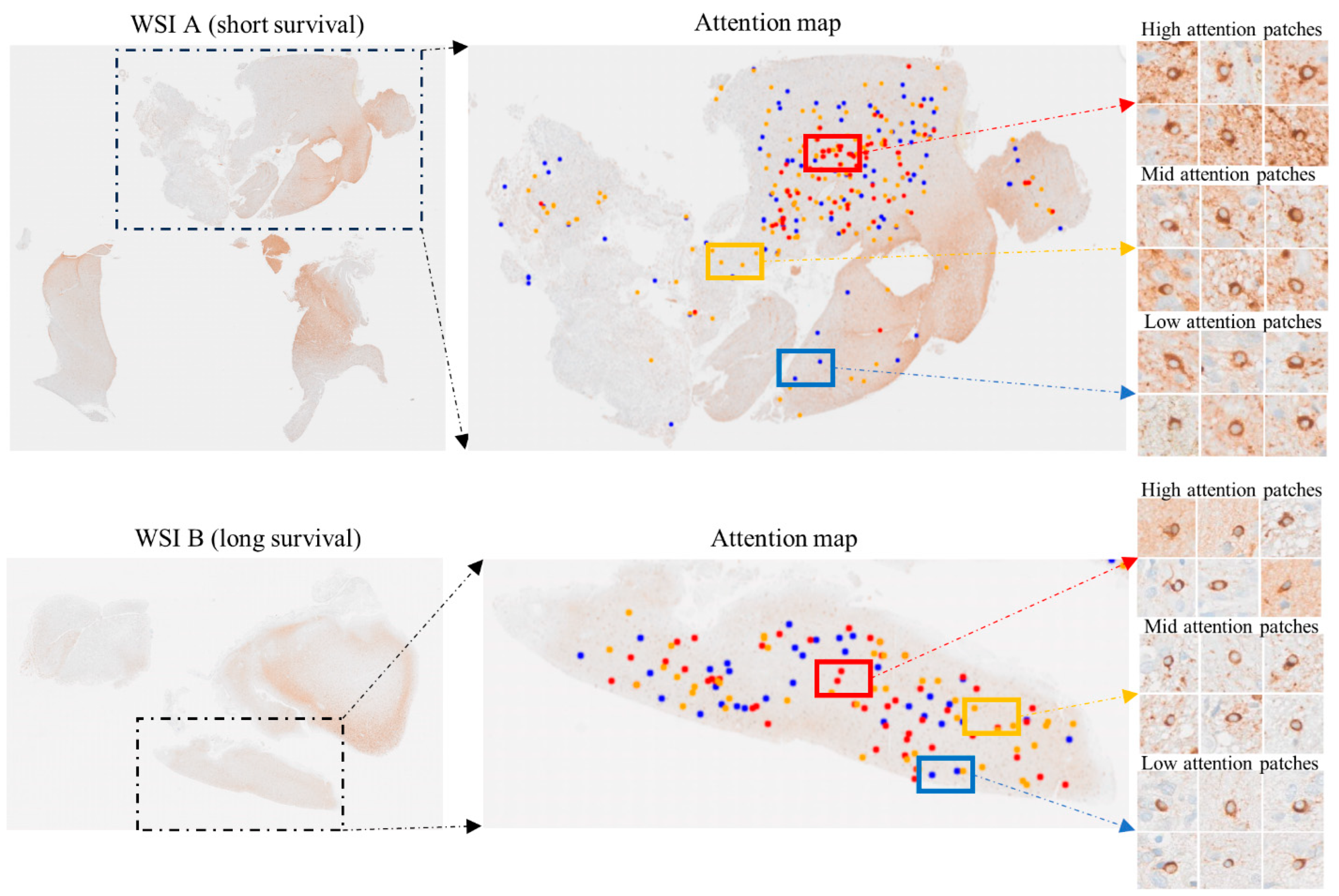 Cancers 16 00750 g005
