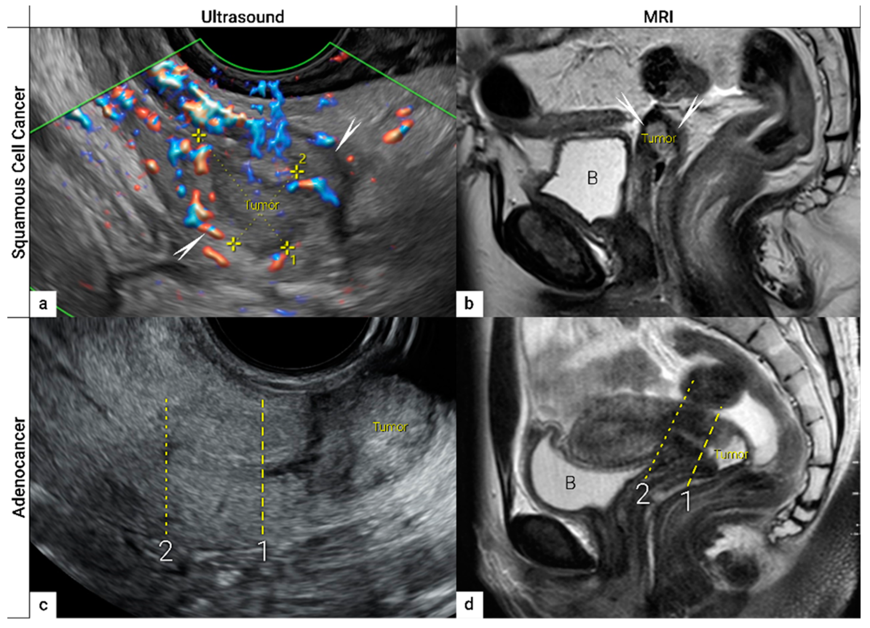 Cancers 16 00775 g004 Cancers 16 00775 g004