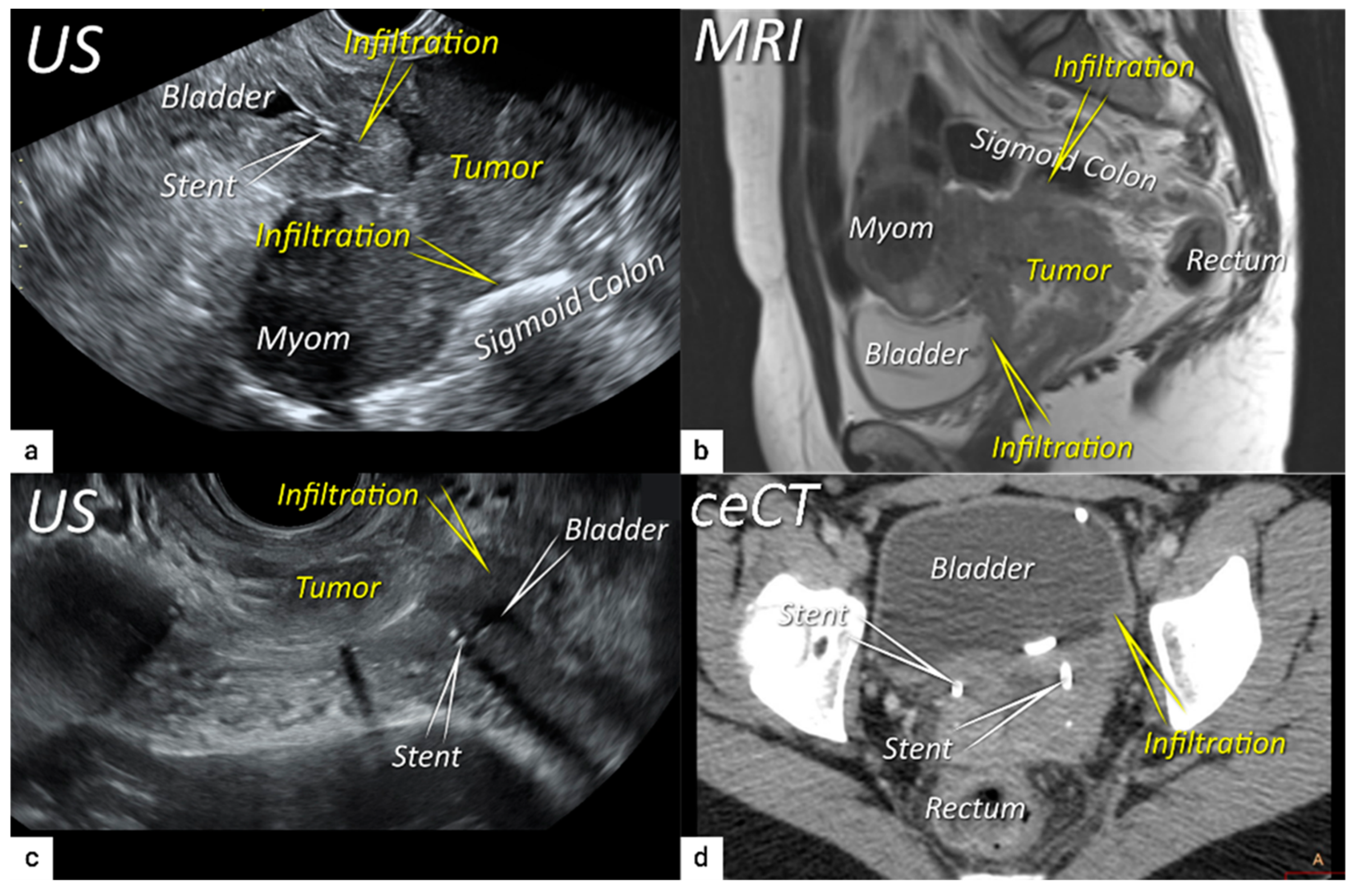 Cancers 16 00775 g006 Cancers 16 00775 g006