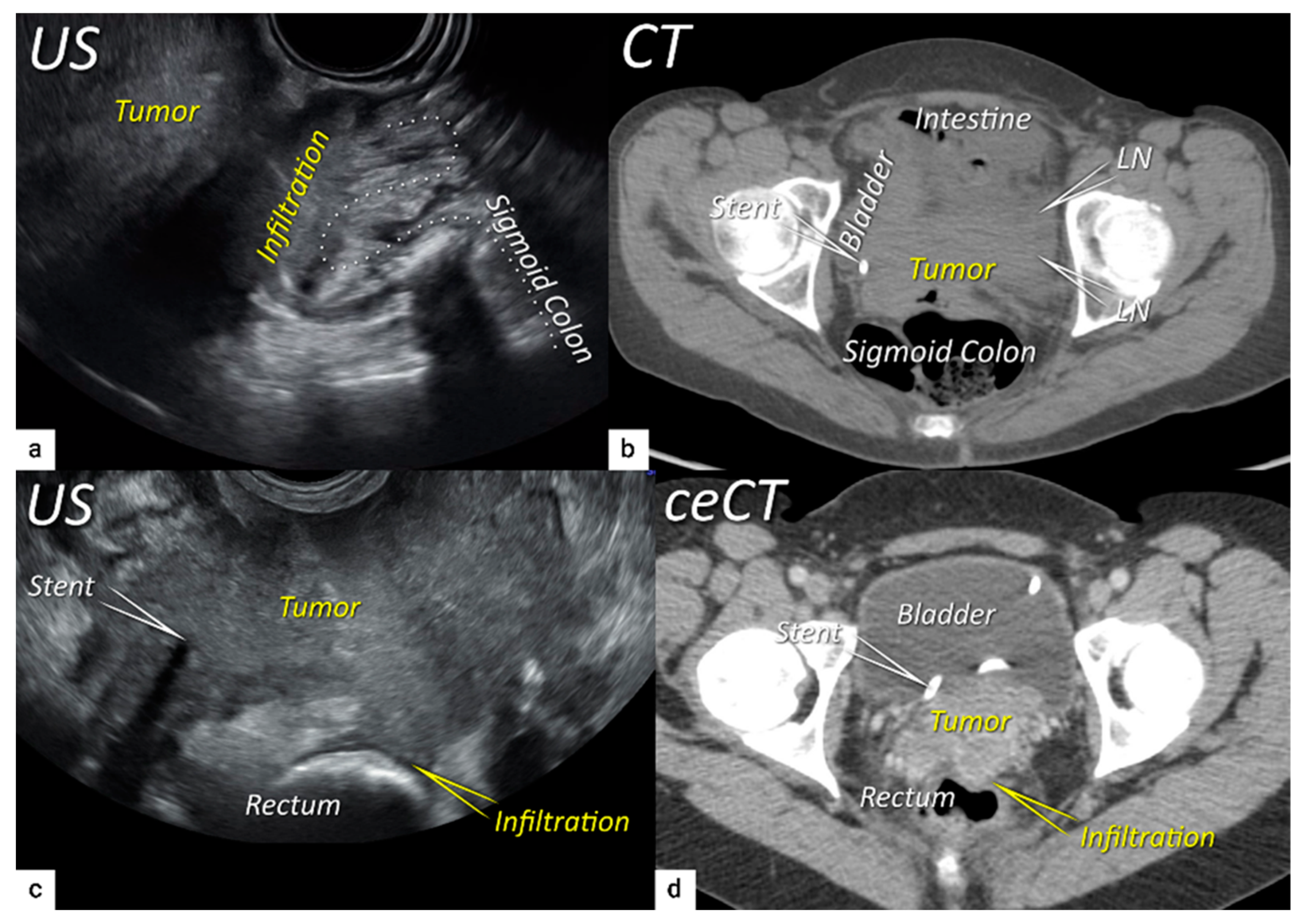 Cancers 16 00775 g007 Cancers 16 00775 g007