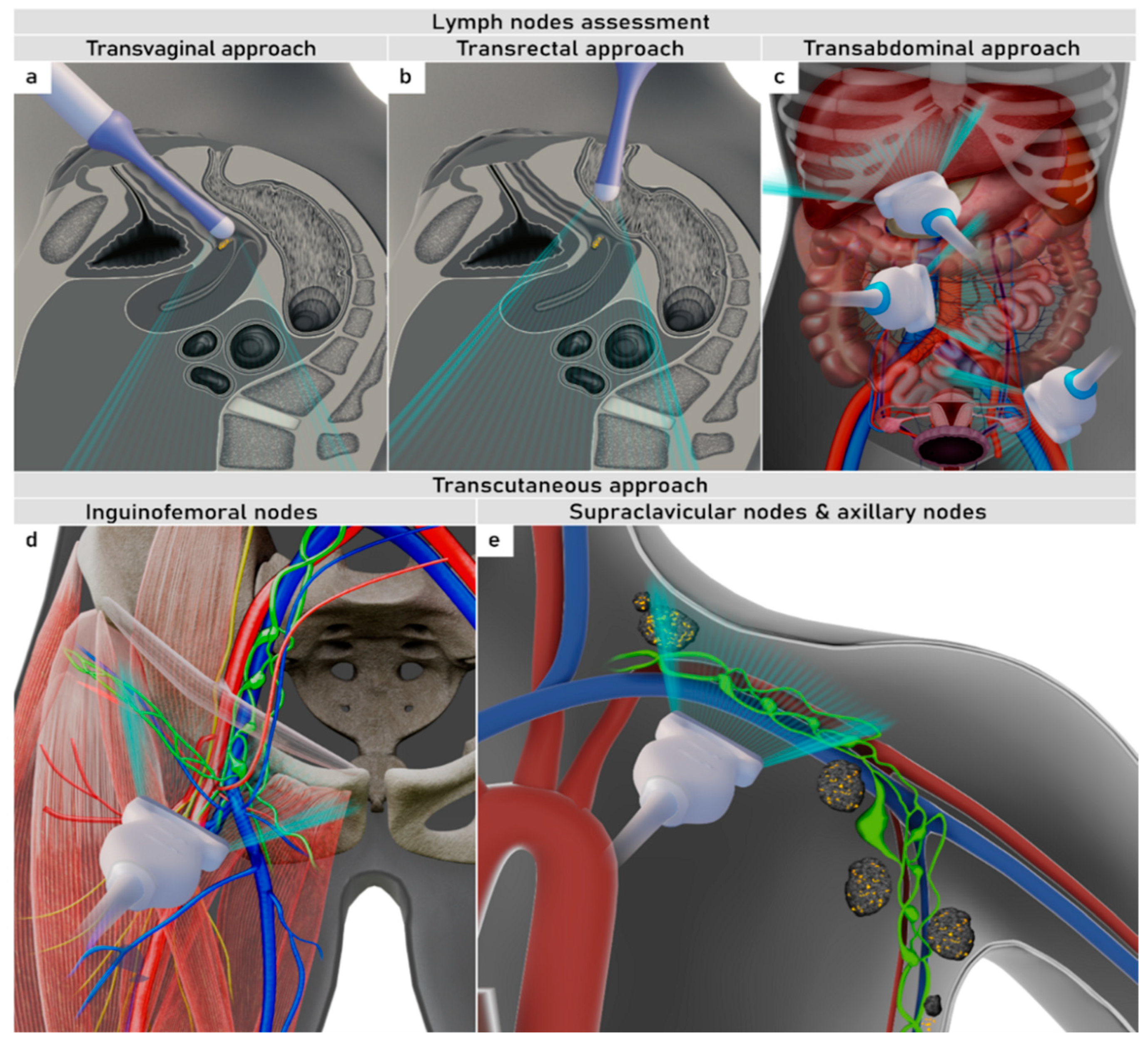 Cancers 16 00775 g008 Cancers 16 00775 g008