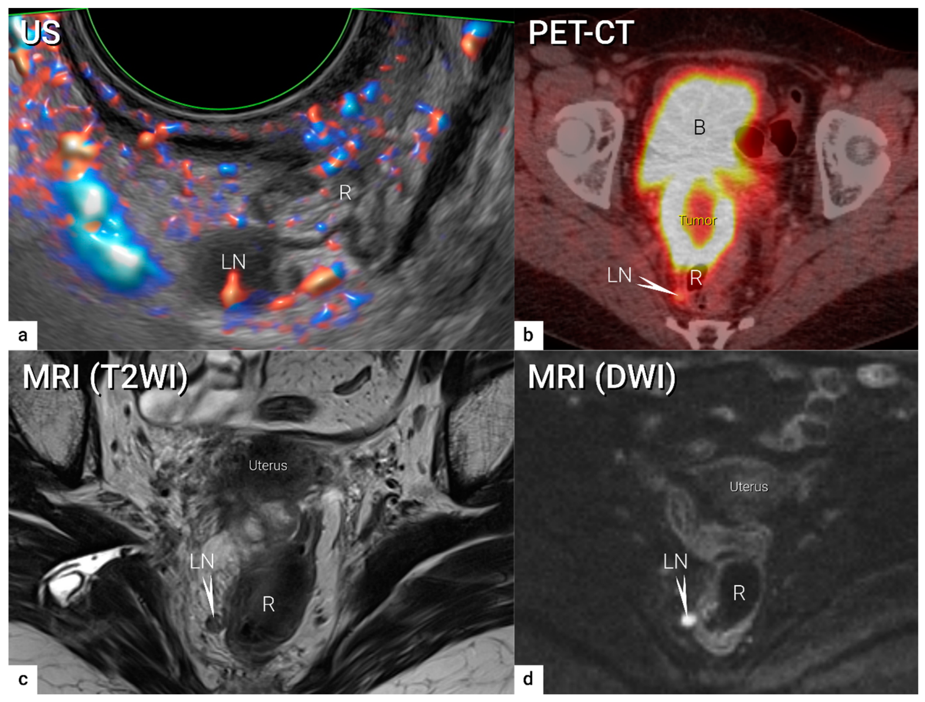 Cancers 16 00775 g010 Cancers 16 00775 g010
