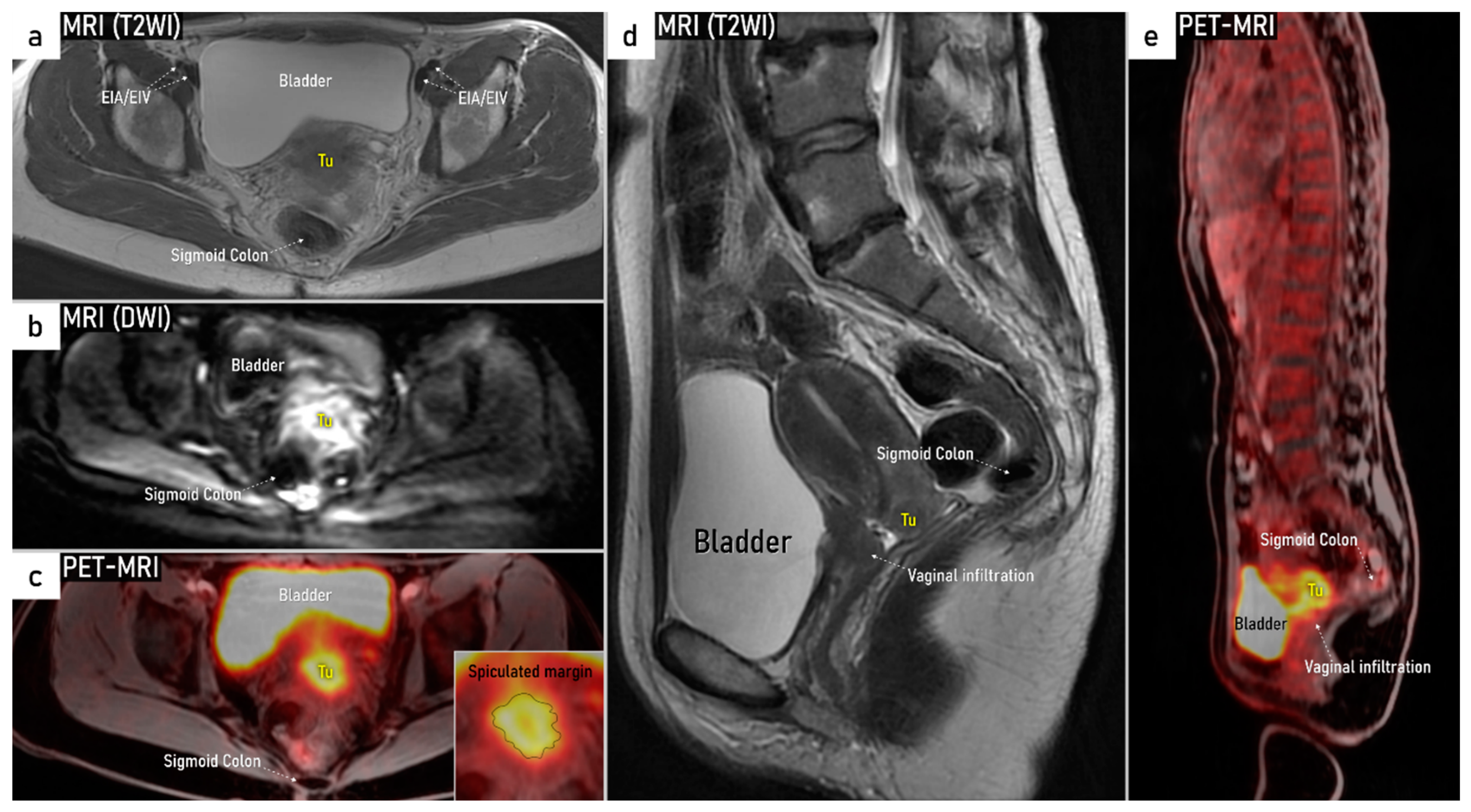 Cancers 16 00775 g011 Cancers 16 00775 g011