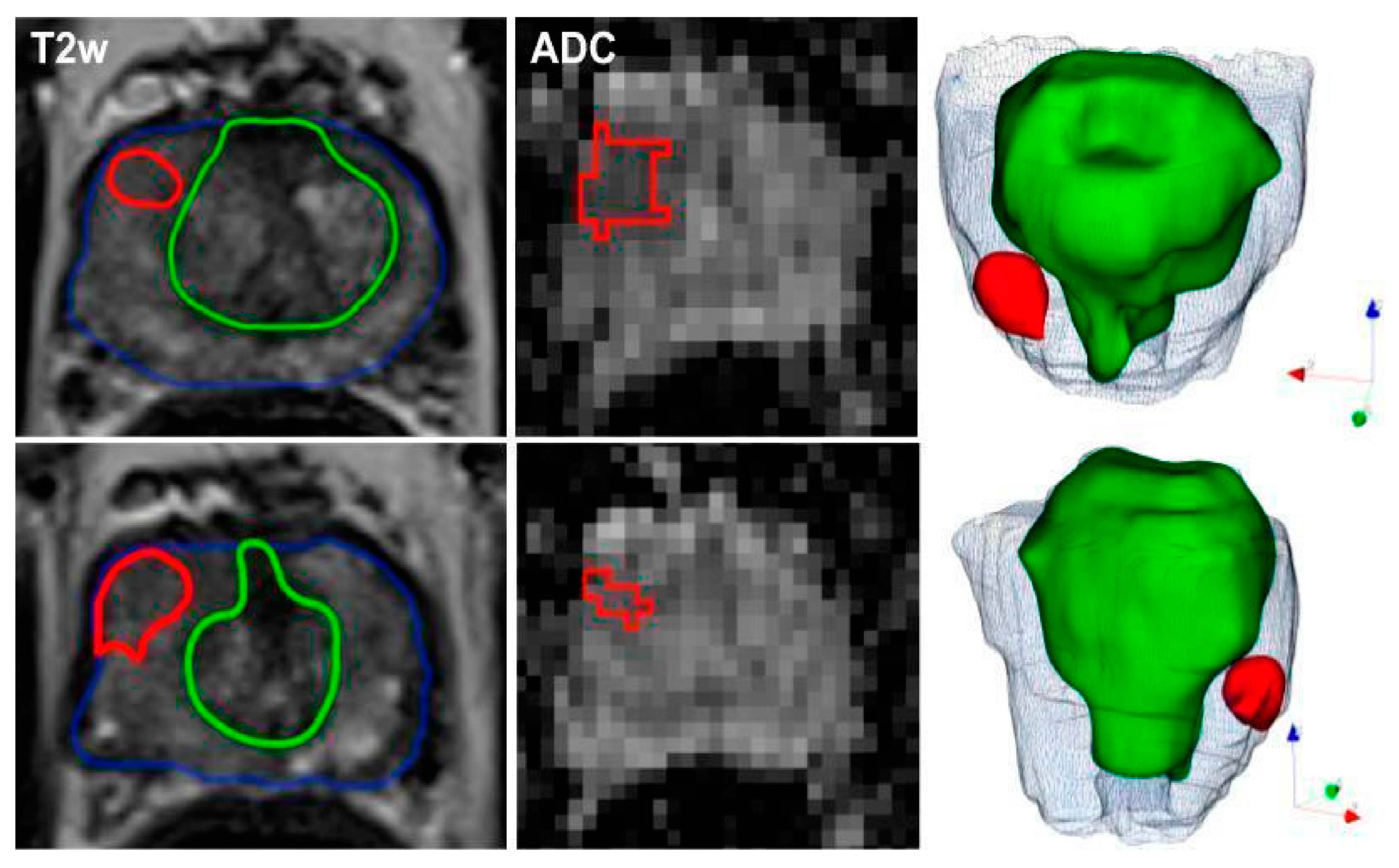 Cancers 16 00810 g002