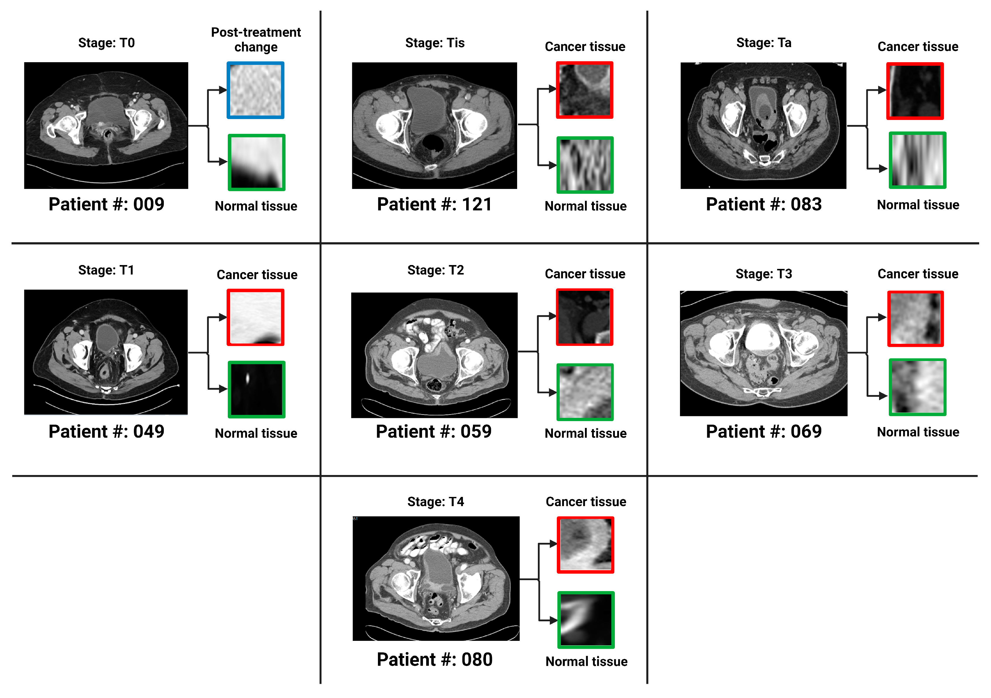 Cancers 16 00810 g003