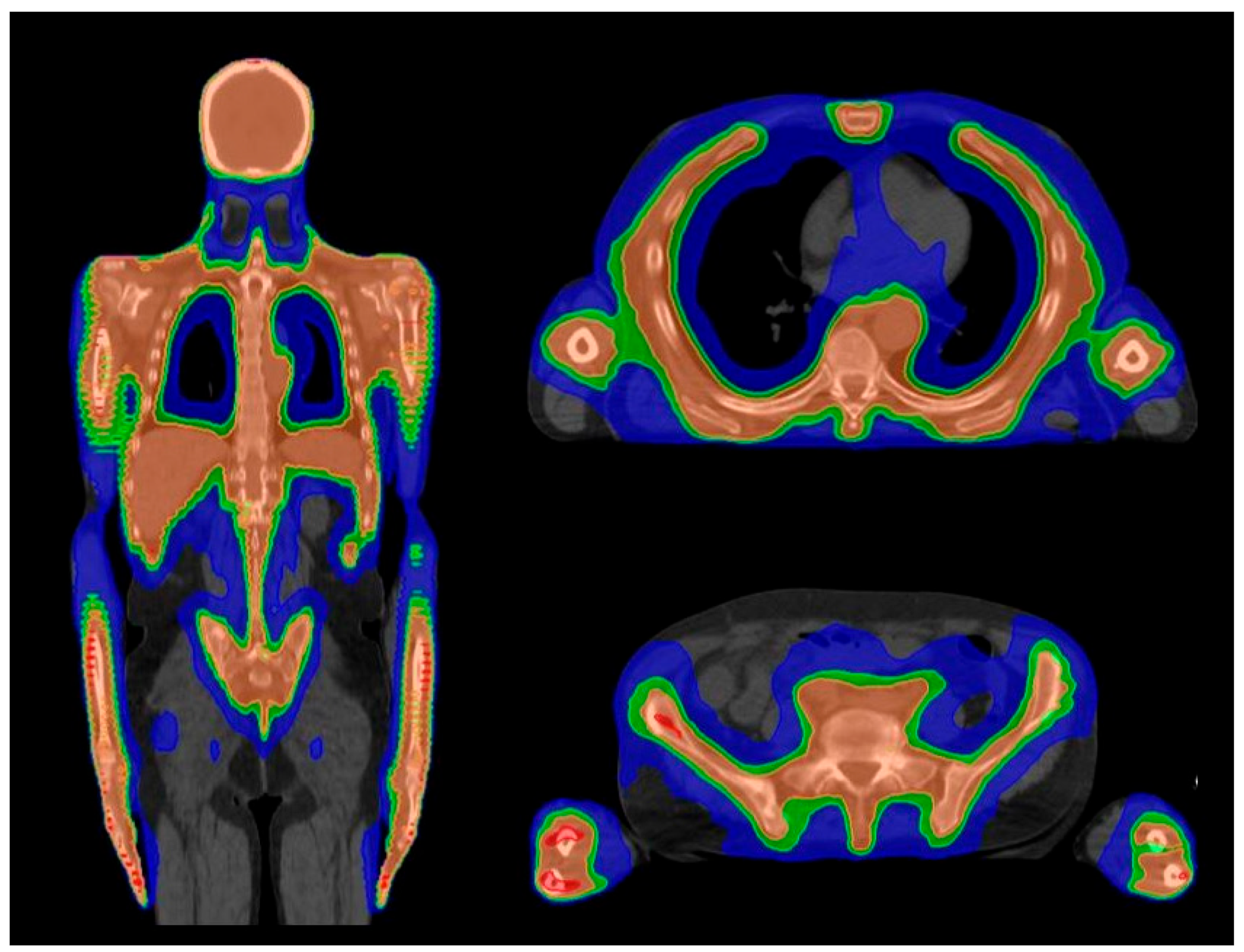 Cancers 16 00865 g001