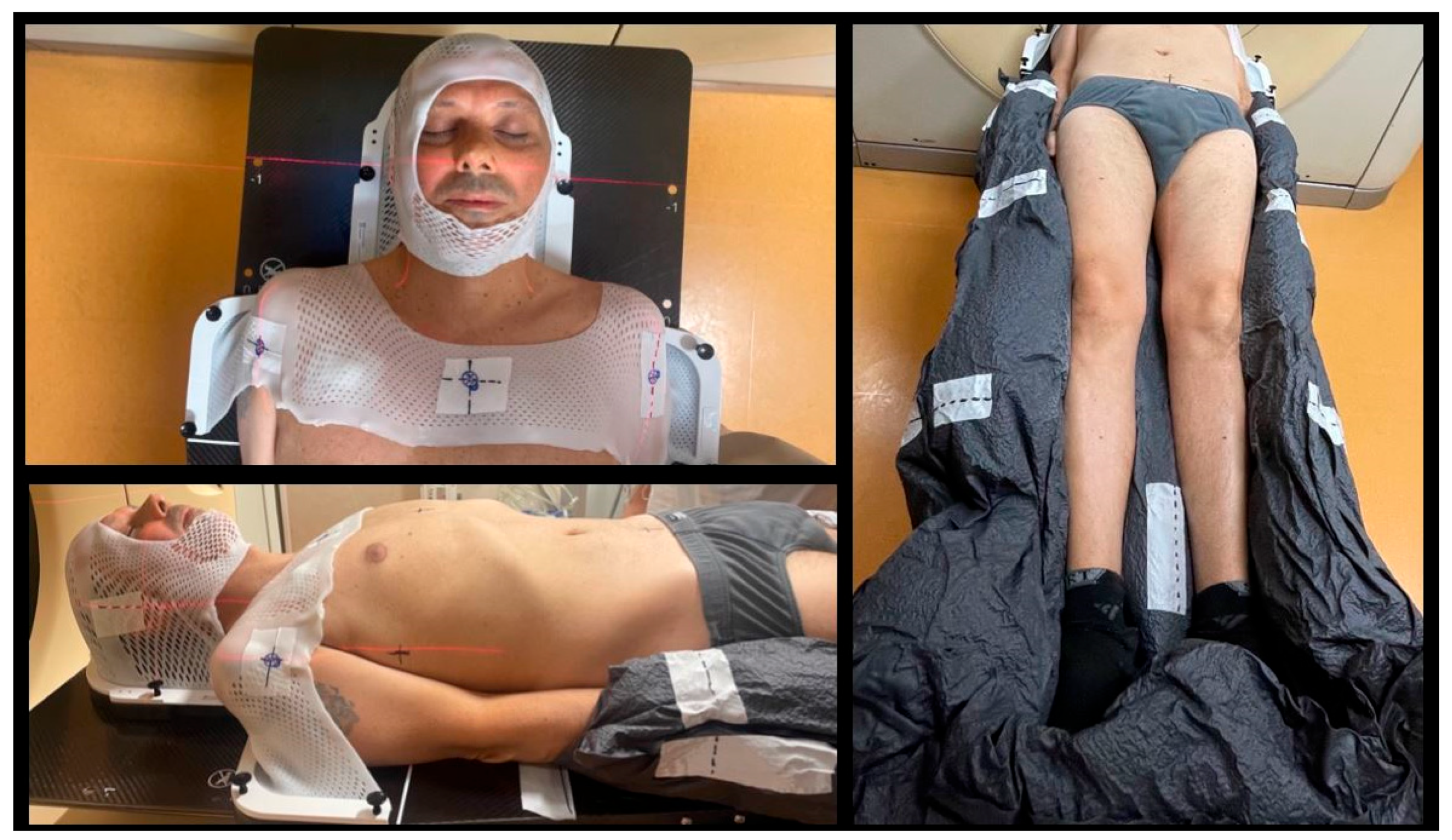 Cancers 16 00865 g002