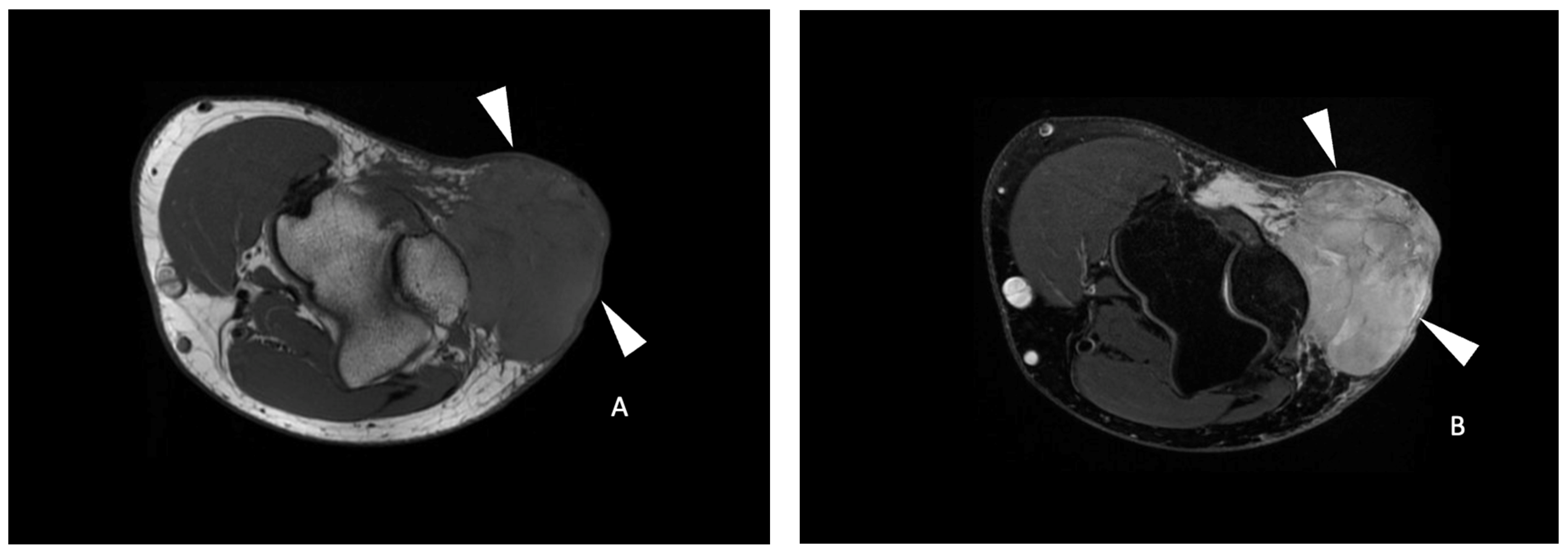 Cancers 16 00878 g003a