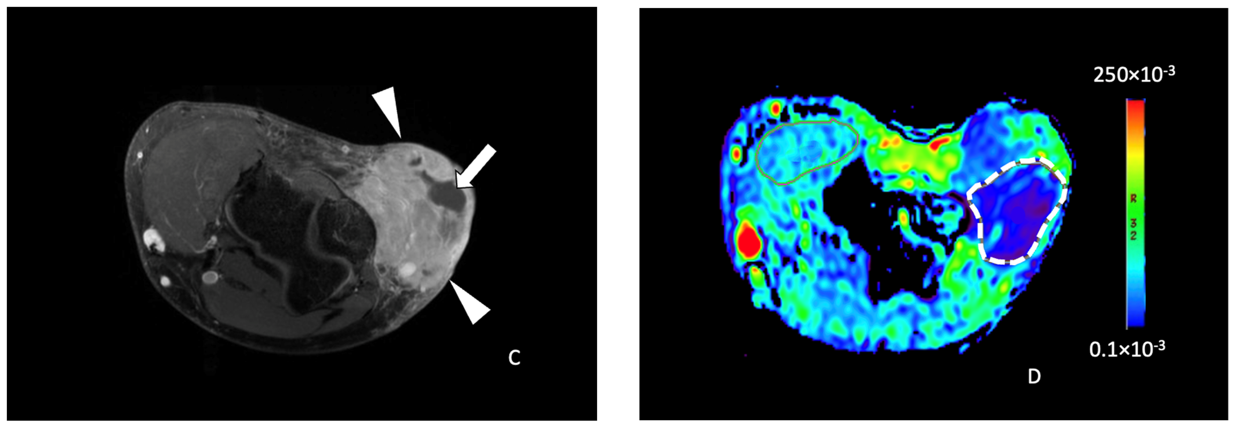 Cancers 16 00878 g003b