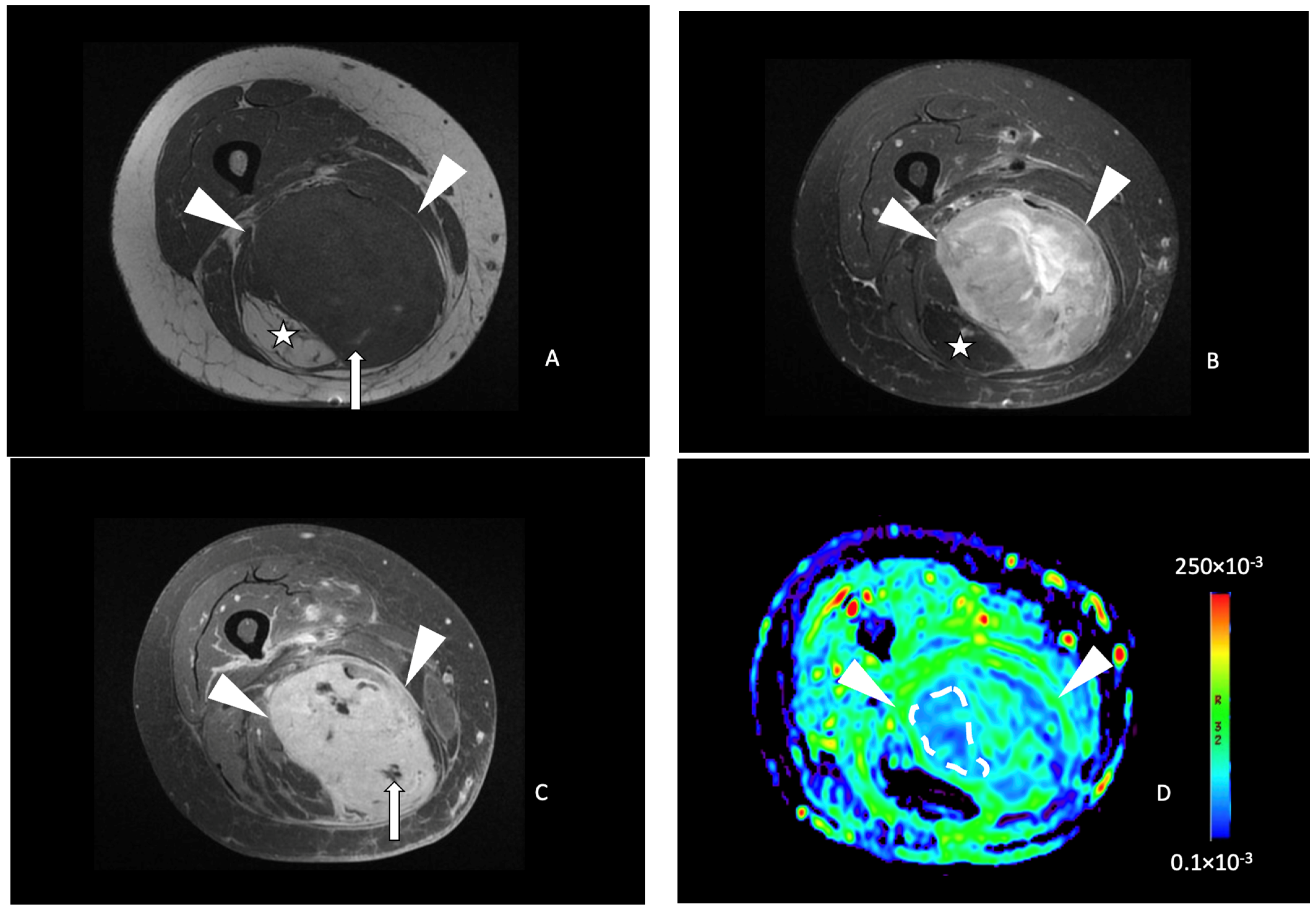 Cancers 16 00878 g004