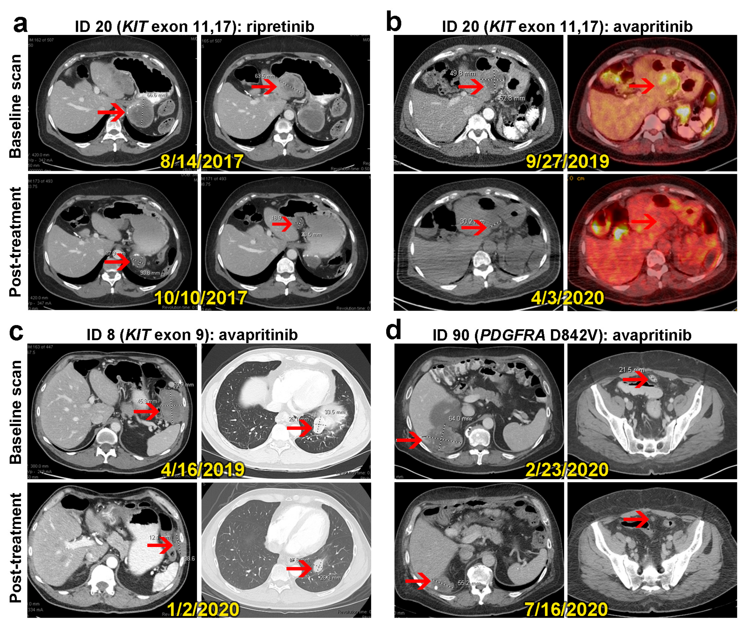 Cancers 16 00904 g004