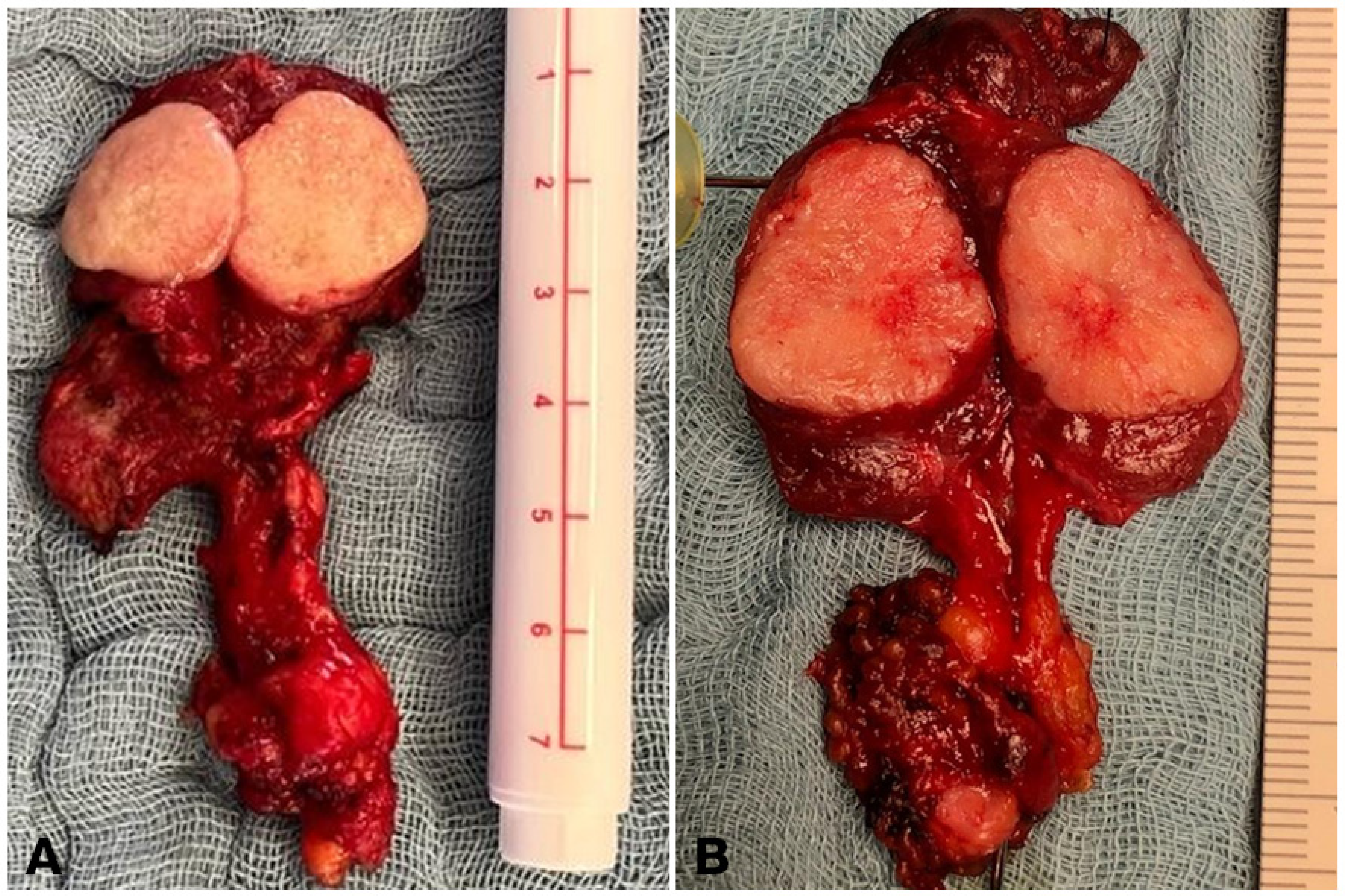 Cancers 16 00917 g002